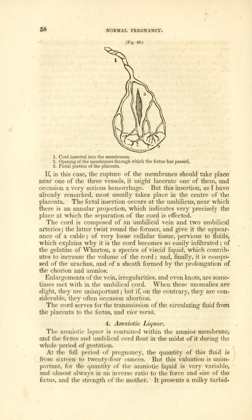 (Fig. 48.) 1. Cord inserted into the membranes. 2. Opening of the membranes through which the fœtus has passed. 3. Foetal portion of the placenta. If, in this case, the rupture of the membranes should take place near one of the three vessels, it might lacerate one of them, and occasion a very serious hemorrhage. But this insertion, as I have already remarked, most usually takes place in the centre of the placenta. The fœtal insertion occurs at the umbilicus, near which there is an annular projection, which indicates very precisely the place at which the separation of the cord is effected. The cord is composed of an umbilical vein and two umbilical arteries ; the latter twist round the former, and give it the appear- ance of a cable ; of very loose cellular tissue, pervious to fluids, which explains why it is the cord becomes so easily infiltrated ; of the gelatine of Wharton, a species of viscid liquid, which contrib- utes to increase the volume of the cord ; and, finally, it is compo- sed of the urachus, and of a sheath formed by the prolongation of the chorion and amnios. Enlargements of the vein, irregularities, and even knots, are some- times met with in the umbilical cord. When these anomalies are slight, they are unimportant; but if, on the contrary, they are con- siderable, they often occasion abortion. The cord serves for the transmission of the circulating fluid from the placenta to the fœtus, and nice rcrsâ. 4. Amniotic Liifuor. The amniotic liquor is contained within the amnios membrane, and the fœtus and umbilical cord float in the midst of it during the Whole period of '_rest;i1ion. At. the full period of pregnancy, the quantity of this fluid is from sixteen to twenty-four ounces. But this valuation is unim- portant, far ihe quantity <>f the amniotic liquid is very variable, and almost always in an inverse ratio to the force and size of the fetus, and the strength of the mother. It presents a milky turbid-