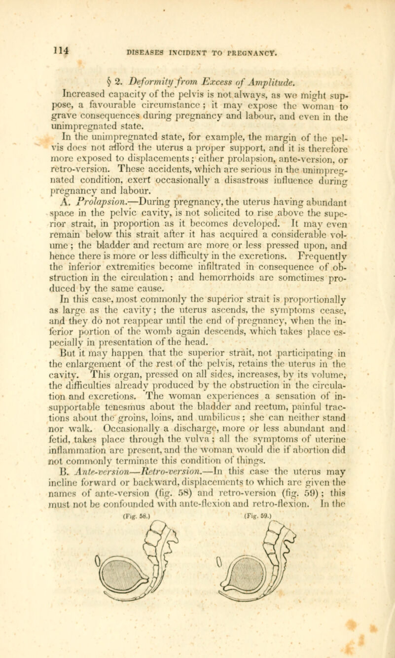 § 2. Deform it y from Excess of Amjililinh'. Increased capacity of thé pelvis is not always, as we might sup- pose, a favourable circumstance; it may expose the woman to grave consequences during pregnancy and labour, and even in the unimpregnated state. In the unimpregnated state, for example, the margin of the pel- vis dors n<»t a-tlbrd the uterus a proper support, and it is therefore more exposed to displacements; either prolapsion, ante-version, or retro-version. These accidents, which are serious in the unimpreg- nated condition, exert occasionally a disastrous influence during pregnancy and labour. A. Prolapsion.—During pregnancy, the uterus having abundant space in the pelvic cavity, is not solicited to rise above the supe- rior strait, in proportion as it becomes developed. It may even remain below this strait after it has acquired a considerable vol- ume ; the bladder and rectum are more or less pressed upon, and hence there is more or less difficulty in the excretions. Frequently the inferior extremities become infiltrated in consequence of ob- struction in the circulation ; and hemorrhoids arc sometimes pro- duced by the same cause. In this case, most commonly the superior strait is proportionally as large as the cavity; the uterus ascends, the symptoms cease, and they do not reappear until the end of-pregnancy, when the in- ferior portion of the womb again descends, which takes place es- pecially in presentation of the head. But it may happen that the superior strait, not participating in the enlargement of the rest of the pelvis, retains the uterus in the cavity. This organ, pressed on all sides, increases, by its volume, the difficulties already produced by the obstruction in the circula- tion and excretions. The woman experiences a sensation of in- supportable tenesmus about the bladder and rectum, painful trac- tions about the groins, loins, and umbilicus; she can neither stand nor walk. Occasionally a discharge, more or less abundant and fetid, takes place through the vulva ; all the symptoms of uterine inflammation are present, and the woman Would die if abortion did nol commonly terminate this condition of things. B. Ante-version—Retro-version.—In this case the uterus may incline forward or backward, displacements to which are given tin» names of ante-version (fig. 58) and retro-version (tig. 59); this must nol be confounded w ith ante-flexion and retro-flexion. In the (Tig. 5b.) (Fig. 59.)