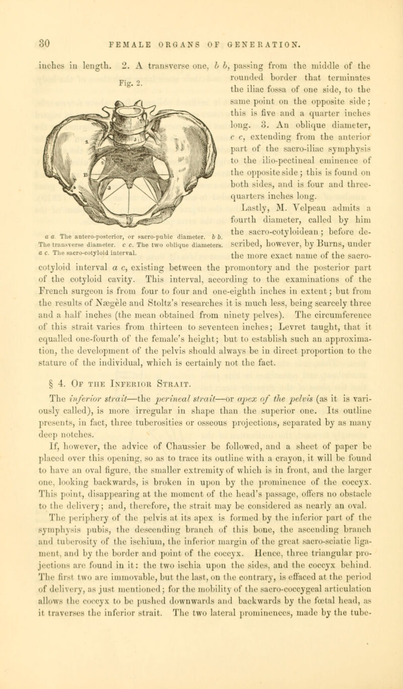 inches in length. 2. A transverse one, Pig. ■_•. A 6, passing from the middle of the rounded border that terminates the iliac fossa of one side, to the same point on the opposite side; this i- five and a quarter inches long, .'5. An oblique diameter, <■ c, extending from the anterior part of the saero-iliae symphysis to the ilio-pectineaJ eminence of the opposite side J this is found en both sides, and is four and three- quarters inches long. Lastly, M. Yelpeau admits a fourth diameter, called by him the Bacro-cotyloidean ; before de- a a The anteroposterior, or sacro-pubic diameter. 6 6. ^ 7 The tranaYerse diameter, c c. The two oblique diameters, scribed, however, by Burns, under a c. The aacPO-COtyloid interval. the m()re cx;R.t Qame of fche Baoro_ cotyloid interval u c, existing between the promontory and the posterior part <>f the cotyloid cavity. This interval, according to the examinations of the French Burgeon is from four to four and one-eighth inches in extent ; but from the results of Naegele and Stoltz's researches it is much less, being scarcely three and a hall' inches (tlie mean obtained from ninety pelves). The circumference of this Strait Varies from thirteen to seventeen inches; Levrot taught, that it equalled one-fourth of the female's height; but to establish such an approxima- tion, the development of the pelvis should always be in direct proportion to the stature of the individual, which is certainly not the fact. § 4. Of the Enferiob Strait. The inferior strait—the perineal strait—or apex of the pelvis (as it is vari- ously called), is more irregular in shape than the superior one. Its outline presents, in fact, three tuberosities or osseous projections, separated by as manj deep notches. If, however, the advice of Chaussier be followed, and a sheet of paper be placed over this opening, so as to trace its outline with a crayon, it will be found to have an oval figure, the smaller extremity of which is in front, and the larger one, looking backwards, is broken in upon by the prominence of the coccyx. This point, disappearing at the moment of the head's passage, offers no obstacle to tie- delivery} ami, therefore, the strait may be considered as nearly an oval. The periphery of the pelvis at its apex is formed by the inferior part of the symphysis pubis, the descending branch of this bone, the ascending branch and tuberosity of the ischium, the inferior margin of the great sacro-sciatie liga- ment, and by the border and point of the coccyx. Hence, three triangular pro- jections are found in it: the two ischia upon the side-, and the coccyx behind. The first two are immovable, but fche last, on the contrary, is effaced at the period of delivery. as just mentioned ; for the mobilit) of the saoro-cocoygeal articulation allow- the coccyx to be pushed downwards and backward.- by the fatal head, a- it traverses the inferior -trait. The two lateral prominences, made by the tube-
