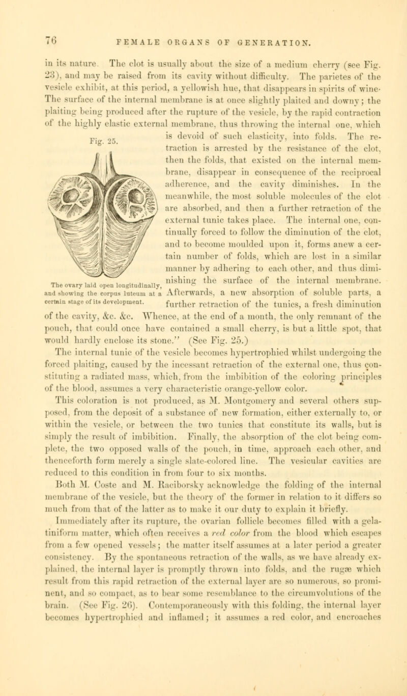 T6 Fig. 25. in its nature The clot is usually about the Bize of a medium cherry (see Fig. 23 and may be raised from its cavity without difficulty. The parietes of the le exhibit, at this period, a yellowish hue, that disappears in spirits of wine- The surface of the internal membrane is at once slightly plaited and downy; the plaiting being produced after the rupture of the vesicle by the rapid contraction of the highly elastic external membrane, thus throwing the interna] one, which is devoid of such elasticity, into folds. The re- traction is arrested by the resistance of the clot, then the folds, that existed on the internal mem- brane, disappear in consequence of the reciprocal adherence, and the cavity diminishes. In the meanwhile, the most soluble molecules of the clot are absorbed, and then a further retraction of the external tunic takes place. The internal one, con- tinually forced to follow the diminution of the clot, and to become moulded upon it. forms anew a cer- tain number of folds, which are lost in a similar manner by adhering to each other, and thus dimi- nishing the surface of the internal membrane. The ovary laid open longitudinally, and showing the corpus Interna at a Afterwards, a new absorption of soluble parts, a certain stage of its development. furtlu.r retraction of the tunics, a fresh diminution of the cavity. &c. &C. Whence, at the end of a month, the only remnant of the pouch, that could once have contained a small cherry, is but a little spot, that would hardly enclose its stone. (See Fig. 25.) The internal tunic of the vesicle becomes hypertrophied whilst undergoing the forced plaiting, caused by the incessant retraction of the external one. thus con- stituting a radiated mass, which, from the imbibition of the coloring principles of the blood, assumes a very characteristic orange-yellow color. This coloration is not produced, as M. Montgomery and several others sup- posed, from the deposit of a substance of new formation, either externally to. or within the vesicle, or between the two tunics that constitute its walls, but is simply the result of imbibition. Finally, the absorption of the (dot being com- plete, the two opposed walls of the pouch, in time, approach each other, and thenceforth form merely a single slate-colored line. The vesicular cavities are reduced to this condition in from Pour to six months. Doth M. Ooste and M. Elaciborsky acknowledge the folding of the internal membrane of the vesicle, but the theory of the former in relation to it differs bo much from that of the latter as to make it our duty t explain it briefly. Immediately after it- rupture, the ovarian follicle becomes filled with a gela- tiniform matter, which often receives a red color from the blood wbioh escapes from ,i few opened vessels; the matter itself assumes at a later period a greater consistency. By the spontaneous retraction of the walls, as we have already ex- plained, the internal layer is promptly thrown into folds, and the rugSB which result Prom this rapid retraction of the external layer are so numerous, bo promi- nent, and -1 compact, as to bear some resemblance to the circumvolutions iA' the brain. (See Fig. 26). Contemporaneously with this folding, the internal layer becomes hypertrophied ami inflamed; it assumes a red color, and encroaches
