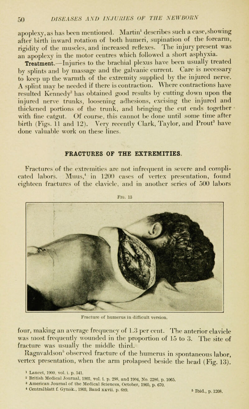 apoplexy, as has been mentioned. Martin1 describes such a case,showing after birth inward rotation of both humeri, supination of the forearm, rigidity of the muscles, and increased reflexes. The injury present was an apoplexy in the motor centres which followed a short asphyxia. Treatment.—Injuries to the brachial plexus have been usually treated by splints and by massage and the galvanic current. Care is necessary to keep up the warmth of the extremity supplied by the injured nerve. A splint may be needed if there is contraction. Where contractions have resulted Kennedy2 has obtained good results by cutting down upon the injured nerve trunks, loosening adhesions, excising the injured and thickened portions of the trunk, and bringing the cut ends together with fine catgut. Of course, this cannot be done until some time after birth (Figs. 11 and 12). Very recently Clark, Taylor, and Prout3 have done valuable work on these lines FRACTURES OF THE EXTREMITIES. Fractures of the extremities are not infrequent in severe and compli- cated labors. Minis,' in 1201) cases of vertex presentation, found eighteen fractures of the clavicle, and in another series of 300 labors Fig. 13 Fracture of humerus in difficult version. four, making an average frequency of 1.3 per cent. The anterior clavicle was most frequently wounded in the proportion of 15 to 3. The site of fracture was usually the middle third. Ragnvaldson* observed fracture of the humerus in spontaneous labor, vertex presentation, when the arm prolapsed beside the head (Fig. 13). 1 Lancet, 1900. vol. i. p. Ml. 2 British Medical Journal, 1903. vol. i. p. 298, and 1904, No 2286, p. 1065. 3 American Journal of the Medical Sciences, October, 1905, p. 670. • Central Matt f. G ynak., 1903, Band xxvii. p. 689.