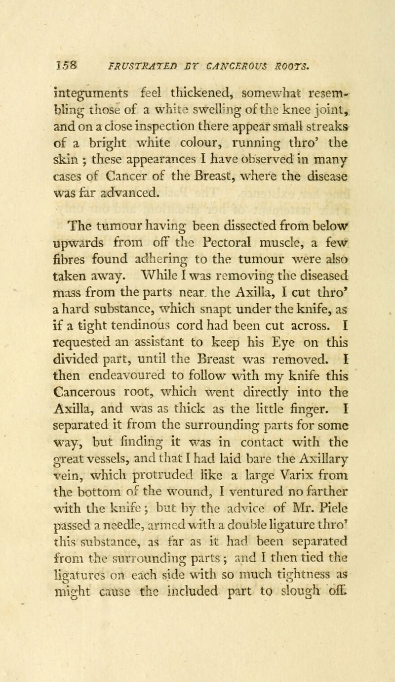 integuments feel thickened, somevwhat resem- bling those of a white swelling of the knee joint, and on a close inspection there appear small streaks of a bright white colour, running thro' the skin ; these appearances I have observed in many cases of Cancer of the Breast, where the disease was far advanced. The tumour having been dissected from below upwards from off the Pectoral muscle, a few fibres found adhering to the tumour were also taken away. While I was removing the diseased mass from the parts near, the Axilla, I cut thro* a hard substance, which snapt under the knife, as if a tight tendinous cord had been cut across. I requested an assistant to keep his Eye on this divided part, until the Breast was removed. I then endeavoured to follow with my knife this Cancerous root, which v/ent directly into the Axilla, and was as thick as the little finger. I separated it from the surrounding parts for some way, but finding it was in contact with the great vessels, and that I had laid bare the Axillary vein, which protruded like a large Varix from the bottom of the wound, I ventured no farther with the knife ; but by the advice of Mr. Piele passed a needle, armed with a double ligature thro' this substance, as far as it had been separated from the surrounding parts ; rrnd I then tied the ligatures on each side with so much tightness as might cause the included part to slough off.