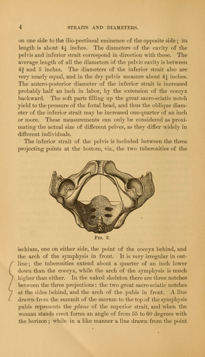 on one side to the ilio-pectineal eminence of the opposite side ; its length is abont 4J inches. The diameters of the cavity of the pelvis and inferior strait correspond in direction with these. The average length of all the diameters of the pelvic cavity is between 4f and 5 inches. The diameters of the inferior strait also are very nearly equal, and in the dry pelvis measure abont 4i inches. The antero-posterior diameter of the inferior strait is increased probably half an inch in labor, by the extension of the coccyx backward. The soft parts filling up the great sacro-sciatic notch yield to the pressure of the foetal head, and thus the oblique diam- eter of the inferior strait may be increased one-quarter of an inch or more. These measurements can only be considered as proxi- mating the actual size of different pelves, as they differ widely in different individuals. The inferior strait of the pelvis is included between the three projecting points at the bottom, viz., the two tuberosities of the Fig. 2. ischium, one on either side, the point of the coccyx behind, and the arch of the symphysis in front. It is very irregular in out- line ; the tuberosities extend about a quarter of an inch lower down than the coccyx, while the arch of the symphysis is much higher than either. In the naked skeleton there are three notches between the three projections: the two great sacro-sciatic notches at the sides behind, and the arch of the pubis in front. A line drawn from the summit of the sacrum to the top of the symphysis pubis represents the plane of the superior strait, and when the woman stands erect forms an angle of from 55 to 60 degrees with the horizon ; while in a like manner a line drawn from the point