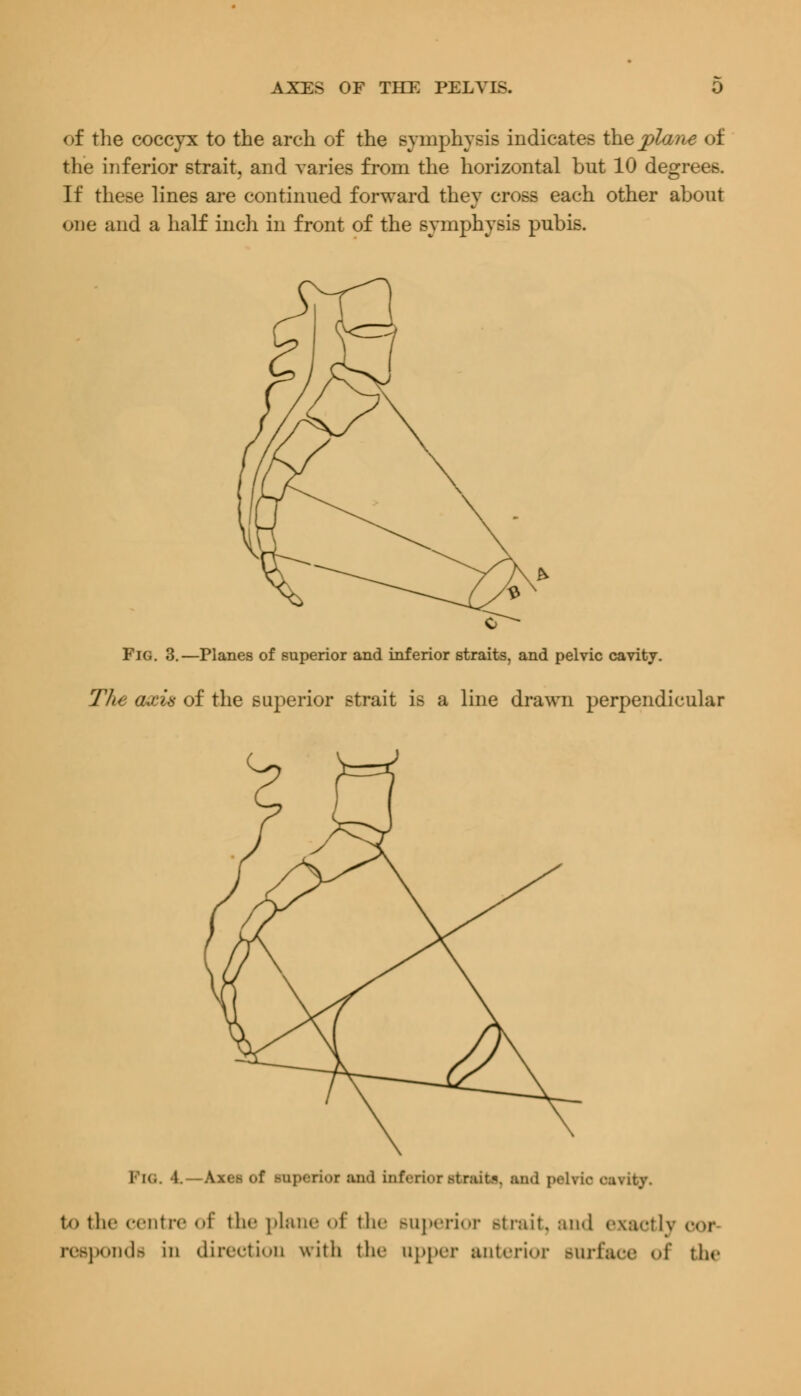 of the coccyx to the arch of the symphysis indicates the pla?ie of the inferior strait, and varies from the horizontal but 10 degrees. If these lines are continued forward they cross each other about one and a half inch in front of the symphysis pubis. Fig. 3.—Planes of superior and inferior straits, and pelvic cavity. The axis of the superior strait is a line drawn perpendicular in. 1 Am-.- of Baperioz md inferior straits, rod pelvic osTity. to the centre of the plane of the Buperior strait, and exactly oor responds in direction with the upper anterior surface of the