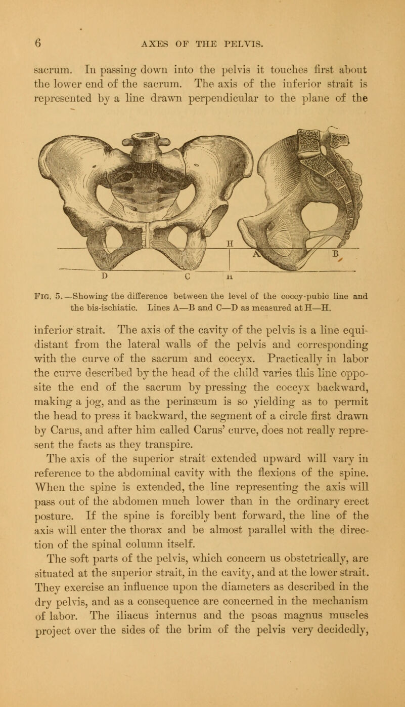 sacrum. In passing down into the pelvis it touches first about the lower end of the sacrum. The axis of the inferior strait is represented by a line drawn perpendicular to the plane of the Fig. 5.—Showing1 the difference between the level of the coccy-pubic line and the bis-ischiatic. Lines A—B and C—D as measured at H—H. inferior strait. The axis of the cavity of the pelvis is a line equi- distant from the lateral walls of the pelvis and corresponding with the curve of the sacrum and coccyx. Practically in labor the curve described by the head of the child varies this line oppo- site the end of the sacrum by pressing the coccyx backward, making a jog, and as the perinaeum is so yielding as to permit the head to press it backward, the segment of a circle first drawn by Cams, and after him called Carus' curve, does not really repre- sent the facts as they transpire. The axis of the superior strait extended upward will vary in reference to the abdominal cavity with the flexions of the spine. When the spine is extended, the line representing the axis will pass out of the abdomen much lower than in the ordinary erect posture. If the spine is forcibly bent forward, the line of the axis will enter the thorax and be almost parallel with the direc- tion of the spinal column itself. The soft parts of the pelvis, which concern us obstetrically, are situated at the superior strait, in the cavity, and at the lower strait. They exercise an influence upon the diameters as described in the dry pelvis, and as a consequence are concerned in the mechanism of labor. The iliacus internus and the psoas magnus muscles project over the sides of the brim of the pelvis very decidedly,