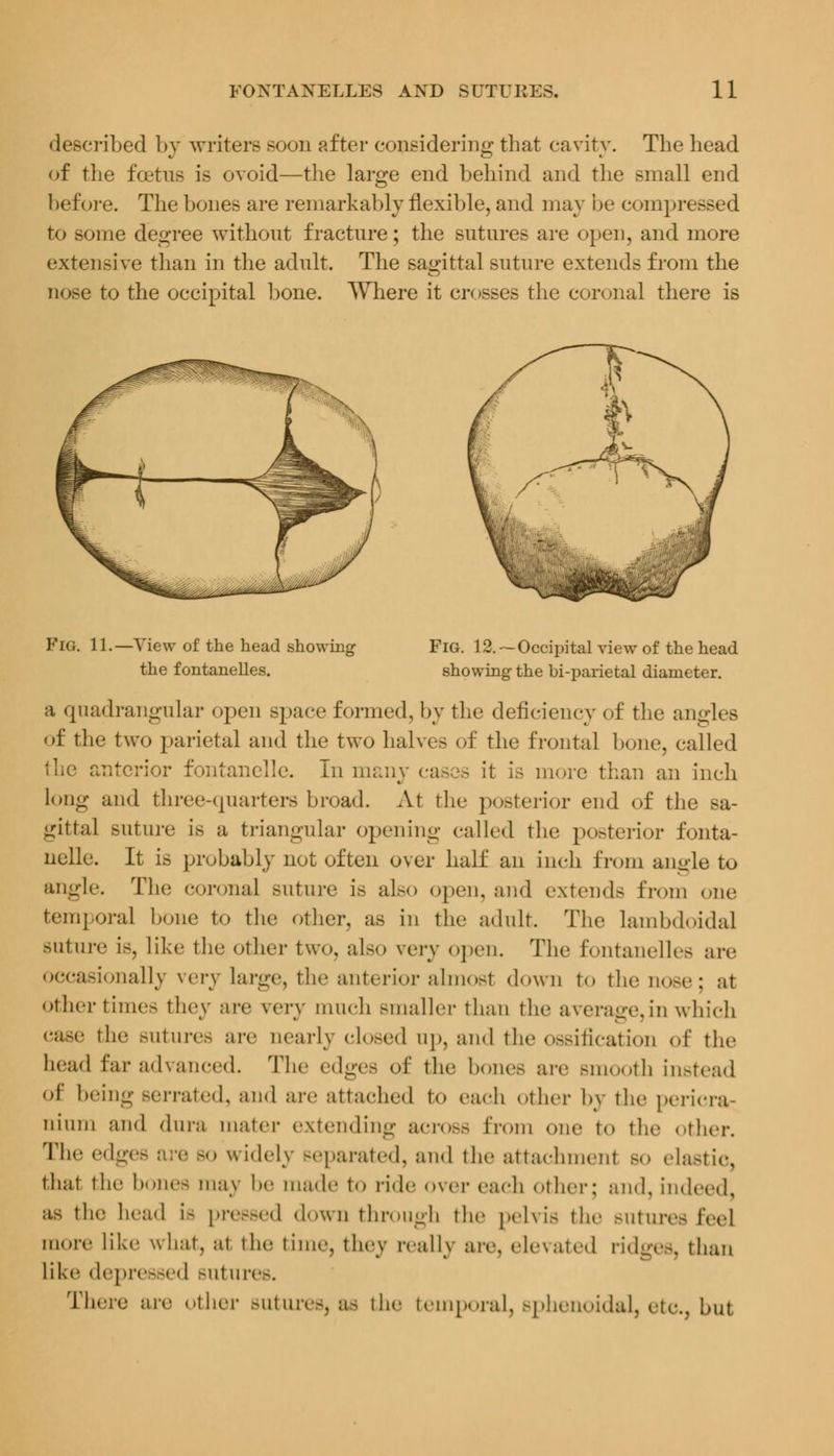 described by writers soon after considering that cavity. The head of the fcetns is ovoid—the large end behind and the small end before. The bones are remarkably flexible, and may be c< impressed to some degree without fracture; the sutures are open, and more extensive than in the adult. The sagittal suture extends from the nose to the occipital bone. Where it crosses the coronal there is Fig. 11.—View of the head showing the forganelles. Fig. 12.—Occipital view of the head showing the bi-parietal diameter. a quadrangular open space formed, by the deficiency of the angles of the two parietal and the two halves of the frontal bone, called the anterior fontanelle. In many cases it is more than an inch long and three-quarters broad. At the posterior end of the sa- gittal suture is a triangular opening called the posterior fonta- nelle. It is probably not often over half an inch from angle to angle. The coronal Buture is also open, and extends from one temporal bone to the other, as in the adult. The lambdoidal suture is, like the other two, also very open. The fontanelles are occasionally wry large, the anterior almost down to the nose; at othertimes they are very much smaller than the average, in which case the sutures are uearly closed up, and the ossification of the head far advanced. The edges o£ the bones arc Bmooth instead of being Berrated, and arc attached to each other by the pericra- nium and dura mater extending across from one to the other. The edgi » widely separated, and the attachment bo elastic, that the bones may be made to ride over each ether: and, indeed, as the head is pressed down through the pelvis the Butures feel more like what, at the time, thev really are, elevated ridges, than like depressed sutures. There are other sutures, as the temporal, sphenoidal, etc., bui