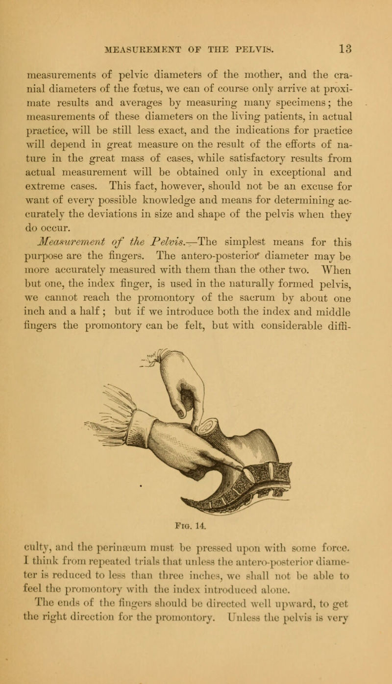 measurements of pelvic diameters of the mother, and the cra- nial diameters of the foetus, we can of course only arrive at proxi- mate results and averages by measuring many specimens; the measurements of these diameters on the living patients, in actual practice, will be still less exact, and the indications for practice will depend in great measure on the result of the efforts of na- ture in the great mass of cases, while satisfactory results from actual measurement will be obtained only in exceptional and extreme cases. This fact, however, should not be an excuse for want of every possible knowledge and means for determining ac- curately the deviations in size and shape of the pelvis when they do occur. Meanurement of the Pelvis.—The simplest means for this purpose are the fingers. The antero-posterior diameter may be more accurately measured with them than the other two. When but one, the index finger, is used in the naturally formed pelvis, we cannot reach the promontory of the sacrum by about one inch and a half ; but if we introduce both the index and middle fingers the promontory can be felt, but with considerable difri- Fro. 14. culty, and the perinfleum nrasl be pressed upon with some i I think from repeated trials that unless the antero-posterior diame ter i- reduced t<> Less than three in<-h< -. we -hall not be able t<> Eeel the promontory with the index introduced alone. The ends of the fingers should he directed well upward, to erel the righl direction for the promontory. Unless the pelvis i> verj