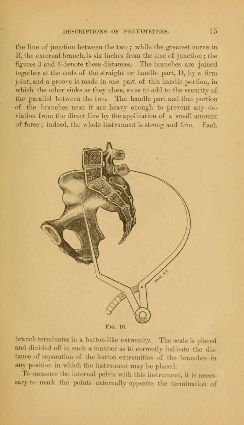 the line of junction between the two ; while the greatest curve in B, the externa] branch, is Bix inches from the line of junction; the figures 3 and G denote these distances. The branches are joined together at the ends of the straight or handle part, D, by a firm joint, and a groove is made in one part of this handle portion, in which the other Binks as they close, so as to add to the security of the parallel between the two. The handle part and that portion of the branches near it arc heavy enough to prevent any de- viation from the direct line by the application of a small amount «»f force j indeed, the whole instrument is strong and linn. Each I'm;. !•:. branch terminates in a button-like extremity. The Bcale is pi and divided off in >u<-h a manner a- to correctly indicate the i tance of separation of the button extremities of the branches in an\ position in which the instrument may he placed. To measure the internal pelvis with this instrument, it i- i Bar) tO mark the points externally Opposite the termination of