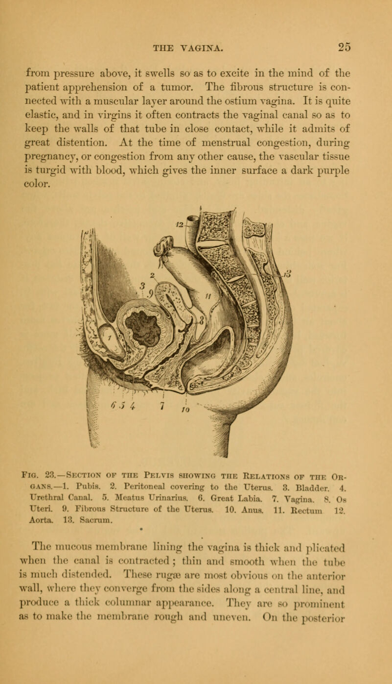 from pressure above, it swells so as to excite in the mind of the patient apprehension of a tumor. The fibrous structure is con- nected with a muscular layer around the ostium vagina. It is cpiite elastic, and in virgins it often contracts the vaginal canal so as to keep the walls of that tube in close contact, while it admits of great distention. At the time of menstrual congestion, during pregnancy, or congestion from any other cause, the vascular tissue is turgid with blood, which gives the inner surface a dark purple color. Pio. 28. Section of the Pelvis showing the Relations of the Or- oans.—1. Pubis. 2. Peritoneal covering to the Uterua ::. Bladder. 4. Urethra] Canal. 5. Meatus Urinaria* G. Great Labia. 7. Vagina. \ <u Uteri. !». Fibrous Structure of the Uterus. 10. Anus. 11. Rectum 12. Aorta. 18. Sacrum. The mucous membrane Lining the vagina is thick and plicated when the canal is contracted; thin and Bmooth when the tube i> much distended. These rugaa are most obvious on the anterior wall, where they converge from the sides along a central Line, and produce a thick columnar appearance. Thej are so prominent as to make the membrane rough and uneven. On the posterior