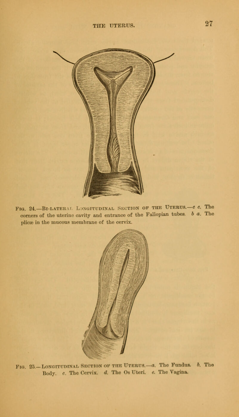 pIGK 24.— Bi-latek.w. L »ngitudinal Section op tiie Uterus.—c c. The corners of the uterine cavity and entrance of the Fallopian tubes, b a. The plica.- in the mucous membrane of the cervix. >'i(i. 85.—Longitudinal Section of the Utebus, a, The Fonda* fc The Body. '• The Oenrix, d. The Os Uteri. >. The Vagina.