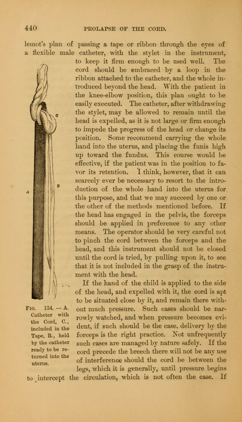 lemot's plan of passing a tape or ribbon through the eyes of a flexible male catheter, with the stylet in the instrument, to keep it firm enough to be used well. The cord should be embraced by a loop in the ribbon attached to the catheter, and the whole in- troduced beyond the head. With the patient in the knee-elbow position, this plan ought to be easily executed. The catheter, after withdrawing the stylet, may be allowed to remain until the head is expelled, as it is not large or firm enough to impede the progress of the head or change its position. Some recommend carrying the whole hand into the uterus, and placing the funis high up toward the fundus. This course would be effective, if the patient was in the position to fa- vor its retention. I think, however, that it can scarcely ever be necessary to resort to the intro- duction of the whole hand into the uterus for this purpose, and that we may succeed by one or the other of the methods mentioned before. If the head has engaged in the pelvis, the forceps should be applied in preference to any other means. The operator should be very careful not to pinch the cord between the forceps and the head, and this instrument should not be closed Uj until the cord is tried, by pulling upon it, to see \i that it is not included in the grasp of the instru- ment with the head. If the hand of the child is applied to the side of the head, and expelled with it, the cord is apt to be situated close by it, and remain there with- out much pressure. Such cases should be nar- rowly watched, and when pressure becomes evi- dent, if such should be the case, delivery by the forceps is the right practice. Xot unfrequently such cases are managed by nature safely. If the cord precede the breech there will not be any use of interference should the cord be between the legs, which it is generally, until pressure begins to intercept the circulation, which is not often the case. If Fig. 154. — A. Catheter with the Cord, C, included in the Tape, B., held by the catheter ready to be re- turned into the uterus.