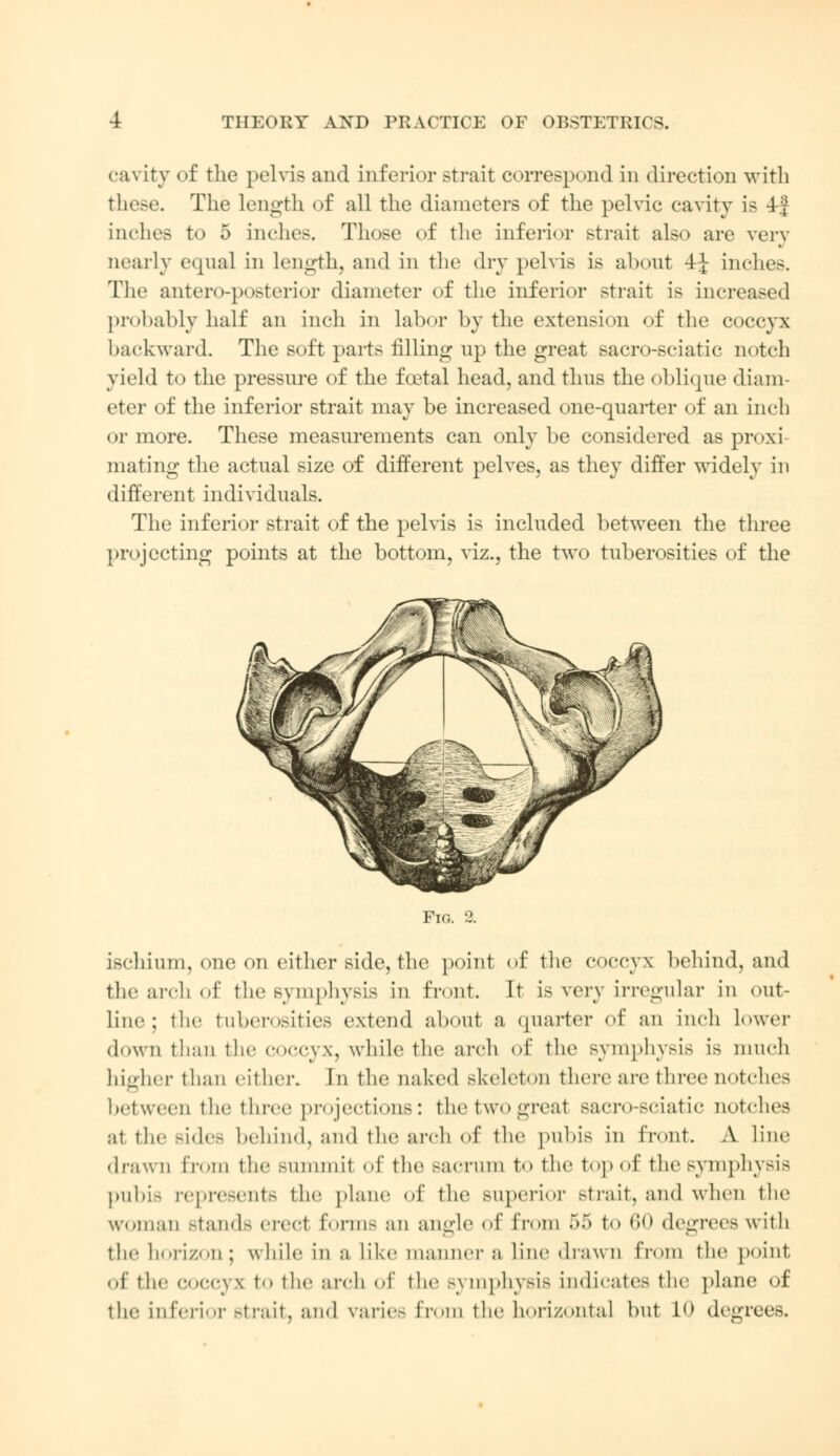 cavity of the pelvis and inferior strait correspond in direction with these. The length of all the diameters of the pelvic cavity is 4j inches to 5 inches. Those of the inferior strait also are very nearly equal in length, and in the dry pelvis is alxmt 4J inches. Tlic antero-posterior diameter of the inferior strait is increased probably half an inch in labor by the extension of the coccyx backward. The soft parts filling up the great sacro-sciatic notch yield to the pressure of the foetal head, and thus the oblique diam- eter of the inferior strait may be increased one-quarter of an inch or more. These measurements can only be considered as proxi mating the actual size of different pelves, as they differ widely in different individuals. The inferior strait of the pelvis is included between the three projecting points at the bottom, viz., the two tuberosities of the Fig. 2. ischium, one on either side, the point of the coccyx behind, and the arch of the symphysis in front. It is very irregular in out- line; the tuberosities extend about a quarter of an inch lower <lown than the coccyx, while the arch of the symphysis is much higher than either. In the naked skeleton there are three notches between the three projections: the two great sacro-sciatic notches at the sides behind, and the arch of the pubis in front. A line drawn from the summit of the sacrum to the top of the symphysis pubis represents the plane of the superior strait, and when the woman stands erect forms an angle of Prom 55 t<> 60 degrees with the horizon; while in a like manner ;i line drawn from the point, of tin- coccyx to the :ireh of the s\mphysis Indicates the plane of the inferior strait, and varies from the horizontal but LO degrees.