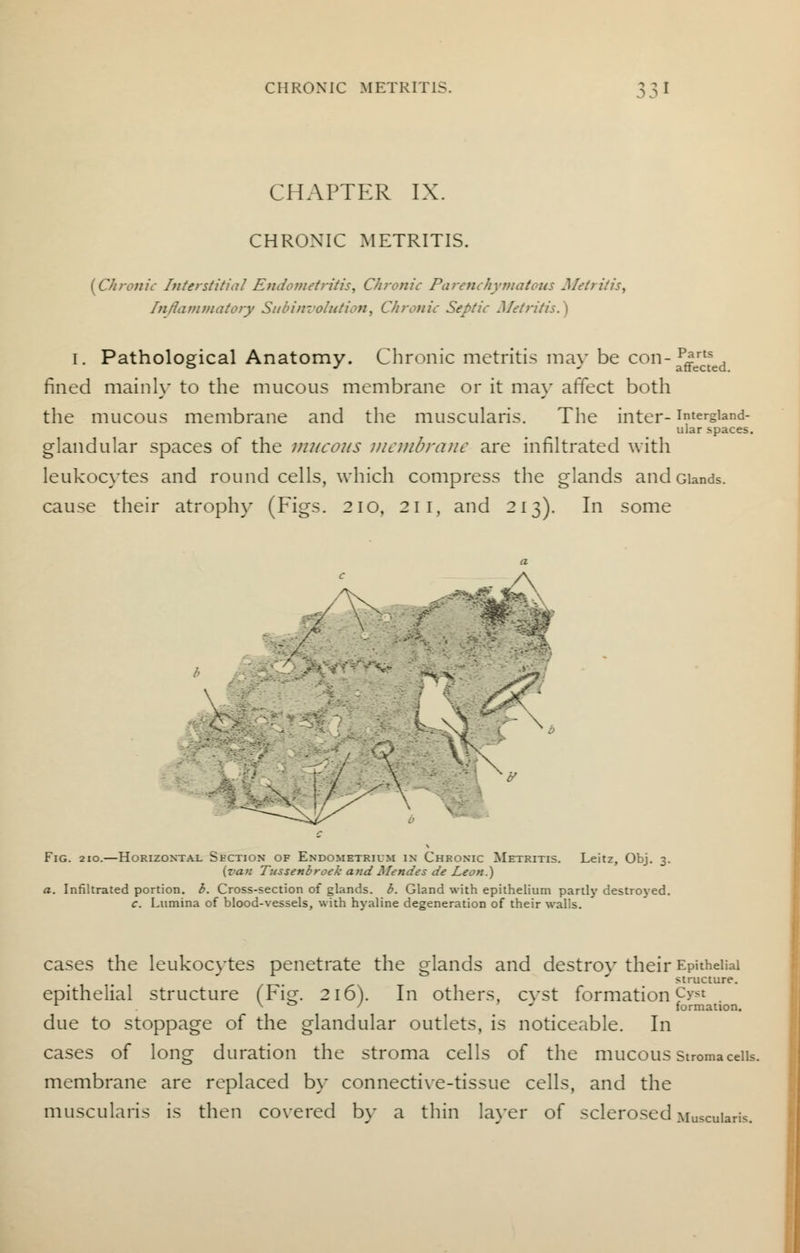 CHAPTER IX. CHRONIC METRITIS. [Chronic Interstitial Endometritis, Chronic Parenchymatous Metritis, Inflammatory Subinvolution, Chronic Septic Metritis.) I. Pathological Anatomy. Chronic metritis may be con-JJj-^ fined mainly to the mucous membrane or it may affect both the mucous membrane and the muscularis. The inter- intergiand- ular spaces. glandular spaces of the mucous membrane are infiltrated with leukocytes and round cells, which compress the glands and Glands, cause their atrophy (Figs. 210, 211, and 213). In some \ Fig. 210.—Horizontal Section of Endometrium in Chronic Metritis. Leitz, Obj. 3. {van Tussenbroek and Mendes de Leon.) a. Infiltrated portion, b. Cross-section of glands, b. Gland with epithelium partly destroyed. c. Lumina of blood-vessels, with hyaline degeneration of their walls. cases the leukocytes penetrate the glands and destroy their Epithelial  structure. epithelial structure (Fi^. 216). In others, cvst formation pr* r \ t> / » J formation. due to stoppage of the glandular outlets, is noticeable. In cases of long duration the stroma cells of the mucous stromaceiu. membrane are replaced by connective-tissue cells, and the muscularis is then covered by a thin layer of sclerosed Moscuiaris.