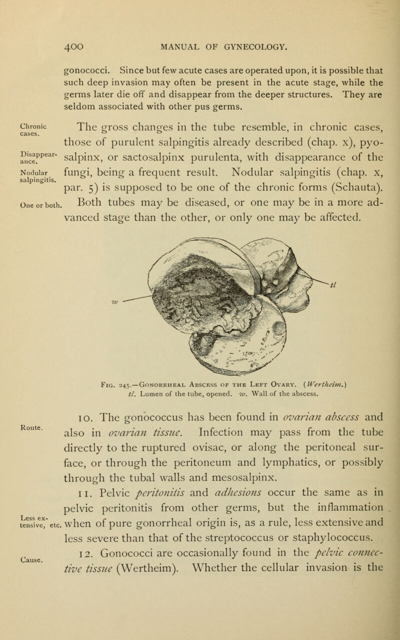 Chronic cases. gonococci. Since but few acute cases are operated upon, it is possible that such deep invasion may often be present in the acute stage, while the germs later die off and disappear from the deeper structures. They are seldom associated with other pus germs. The gross changes in the tube resemble, in chronic cases, those of purulent salpingitis already described (chap, x), pyo- salpinx, or sactosalpinx purulenta, with disappearance of the fungi, being a frequent result. Nodular salpingitis (chap, x, par. 5) is supposed to be one of the chronic forms (Schauta). One or both. Both tubes may be diseased, or one may be in a more ad- vanced stage than the other, or only one may be affected. Disappear ance. Nodular salpingitis. Route. Less ex- tensive, Cause. Fig. 245.—Gonorrheal Abscess of the Left Ovary. (Wertheim.) tl. Lumen of the tube, opened, iv. Wall of the abscess. 10. The gonococcus has been found in ovarian abscess and also in ovarian tissue. Infection may pass from the tube directly to the ruptured ovisac, or along the peritoneal sur- face, or through the peritoneum and lymphatics, or possibly through the tubal walls and mesosalpinx. 11. Pelvic peritonitis and adhesions occur the same as in pelvic peritonitis from other germs, but the inflammation stc. when of pure gonorrheal origin is, as a rule, less extensive and less severe than that of the streptococcus or staphylococcus. 12. Gonococci are occasionally found in the pelvic connec- tive tissue (Wertheim). Whether the cellular invasion is the