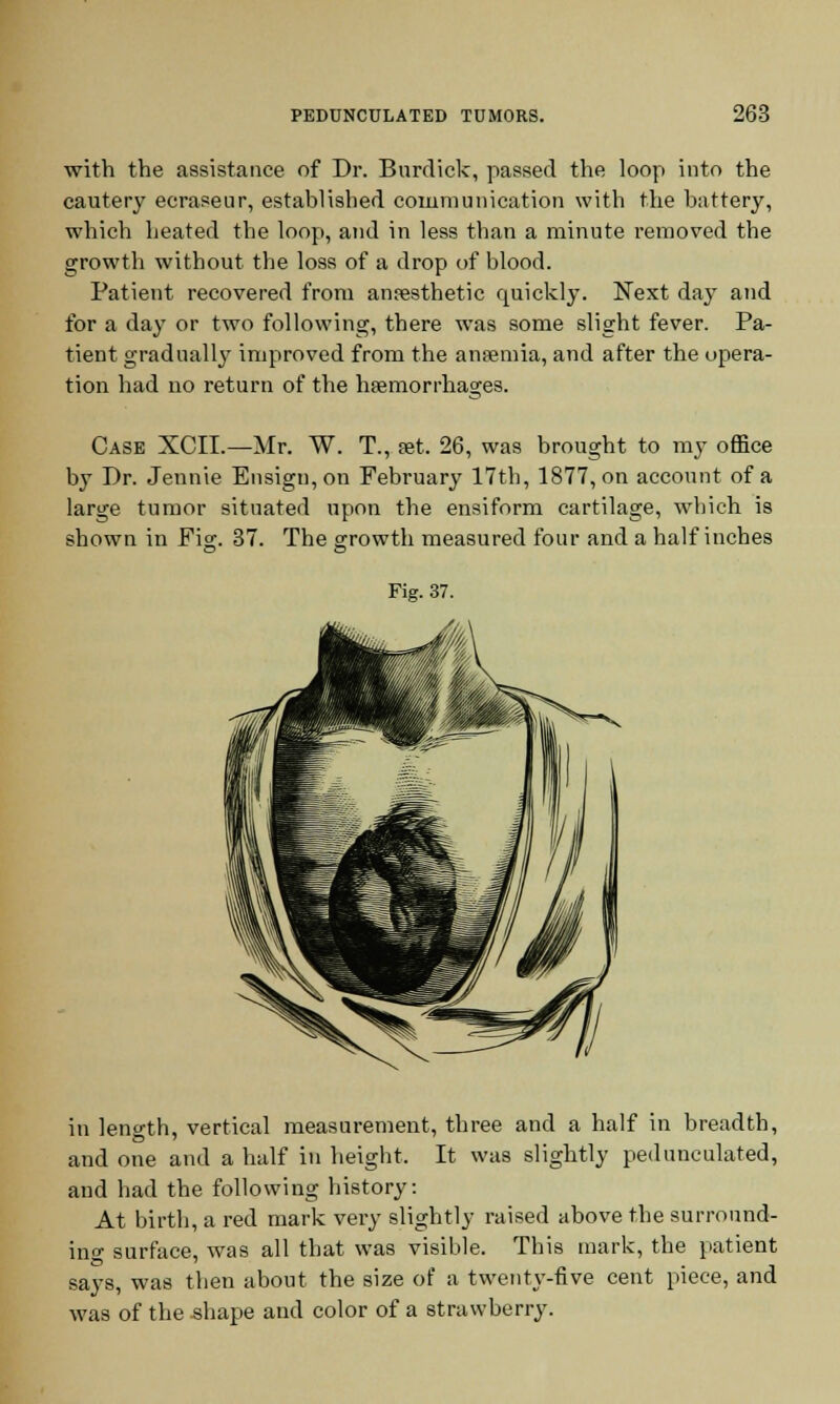 with the assistance of Dr. Burdick, passed the loop into the cautery ecraseur, established communication with the battery, which heated the loop, and in less than a minute removed the growth without the loss of a drop of blood. Patient recovered from anaesthetic quickly. Next day and for a day or two following, there was some slight fever. Pa- tient gradually improved from the anaemia, and after the opera- tion had no return of the haemorrhages. Case XCIL—Mr. W. T., set. 26, was brought to my office by Dr. Jennie Ensign, on February 17th, 1877, on account of a large tumor situated upon the ensiform cartilage, which is shown in Fi°\ 37. The growth measured four and a half inches Fig. 37. in length, vertical measurement, three and a half in breadth, and one and a half in height. It was slightly pedunculated, and had the following history: At birth, a red mark very slightly raised above the surround- ino- surface, was all that was visible. This mark, the patient says, was then about the size of a twenty-five cent piece, and was of the shape and color of a strawberry.