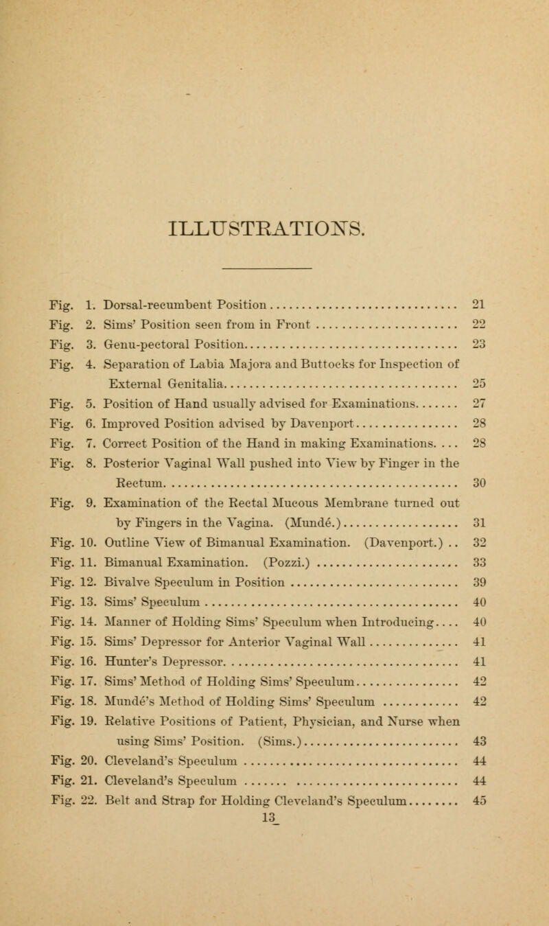 ILLITSTEATIOXS. Fig. 1. Dorsal-recumbent Position 21 Fig. 2. Sims' Position seen frorn in Front 22 Fig. 3. Genu-peetoral Position 23 Fig. 4. Separation of Labia Majors and Buttocks for Inspection of External Genitalia 25 Fig. 5. Position of Hand usually advised for Examinations 27 Fig. 6. Improved Position advised by Davenport 28 Fig. 7. Correct Position of the Hand in making Examinations. ... 28 Fig. 8. Posterior Vaginal Wall pushed into View by Finger in the Rectum 30 Fig. 9. Examination of the Rectal Mucous Membrane turned out by Fingers in the Vagina. (Munde.) 31 Fig. 10. Outline View of Bimanual Examination. (Davenport.).. 32 Fig. 11. Bimanual Examination. (Pozzi.) 33 Fig. 12. Bivalve Speculum in Position 39 Fig. 13. Sims' Speculum 40 Fig. 14. Manner of Holding Sims' Speculum when Introducing 40 Fig. 15. Sims' Depressor for Anterior Vaginal Wall 41 Fig. 16. Hunter's Depressor 41 Fig. 17. Sims' Method of Holding Sims' Speculum 42 Fig. 18. Munde's Method of Holding Sims' Speculum 42 Fig. 19. Relative Positions of Patient. Physician, and Xurse when using Sims' Position. (Sims.) 43 Fig. 20. Cleveland's Speculum 44 Fig. 21. Cleveland's Speculum 44 Fig. 22. Belt and Strap for Holding Cleveland's Speculum 45