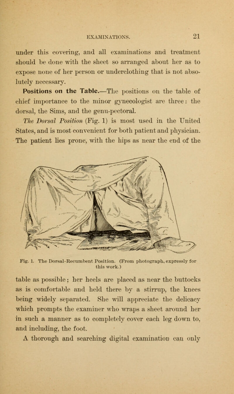 under this covering, and all examinations and treatment should be done with the sheet so arranged about her as to expose none of her person or underclothing that is not abso- lutely necessary. Positions on the Table.—The positions on the table of chief importance to the minor gynecologist are three: the dorsal, the Sims, and the genu-pectoral. The Dorsal Position (Fig. 1) is most used in the United States, and is most convenient for both patient and physician. The patient lies prone, with the hips as near the end of the Fig. The Dorsal-Recumbent Position. (From photograph, expressly for this work.) table as possible; her heels are placed as near the buttocks as is comfortable and held there by a stirrup, the knees being widely separated. She will appreciate the delicacy which prompts the examiner who wraps a sheet around her in such a manner as to completely cover each leg down to, and including, the foot. A thorough and searching digital examination can only