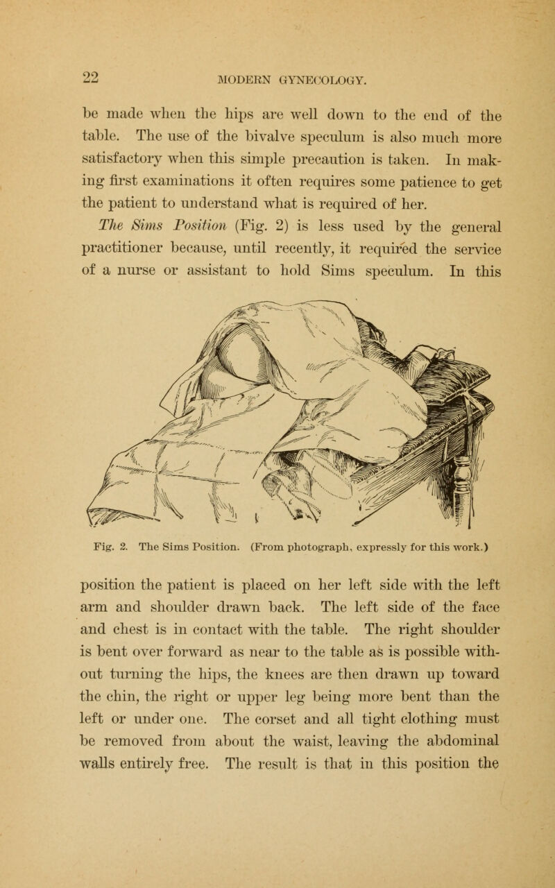 be made when the hips are well down to the end of the table. The use of the bivalve speculum is also much more satisfactory when this simple precaution is taken. In mak- ing first examinations it often requires some patience to get the patient to understand what is required of her. The Sims Position (Fig. 2) is less used by the general practitioner because, until recently, it required the service of a nurse or assistant to hold Sims speculum. In this Fig. 2. The Sims Position. (From photograph, expressly for this work.) position the patient is placed on her left side with the left arm and shoulder drawn back. The left side of the face and chest is in contact with the table. The right shoulder is bent over forward as near to the table as is possible with- out turning the hips, the knees are then drawn up toward the chin, the right or upper leg being more bent than the left or under one. The corset and all tight clothing must be removed from about the waist, leaving the abdominal walls entirely free. The result is that in this position the