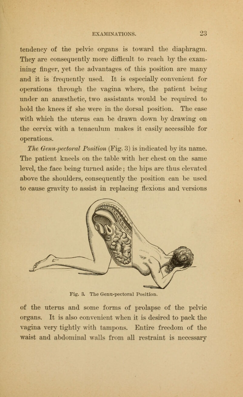 tendency of the pelvic organs is toward the diaphragm. They are consequently more difficult to reach by the exam- ining finger, yet the advantages of this position are many and it is frequently used. It is especially convenient for operations through the vagina where, the patient being under an anaesthetic, two assistants would be required to hold the knees if she were in the dorsal position. The ease with which the uterus can be drawn down by drawing on the cervix with a tenaculum makes it easily accessible for operations. The Genu-pectoral Position (Fig. 3) is indicated by its name. The patient kneels on the table with her chest on the same level, the face being turned aside; the hips are thus elevated above the shoulders, consequently the position can be used to cause gravity to assist in replacing flexions and versions Fig. 3. The Genu-pectoral Position. of the uterus and some forms of prolapse of the pelvic organs. It is also convenient when it is desired to pack the vagina very tightly with tampons. Entire freedom of the waist and abdominal walls from all restraint is necessary