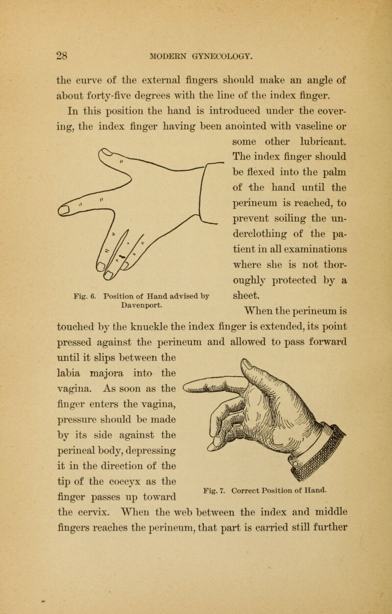 the curve of the external fingers should make an angle of about forty-five degrees with the line of the index finger. In this position the hand is introduced under the cover- ing, the index finger having been anointed with vaseline or some other lubricant. The index finger should be flexed into the palm of the hand until the perineum is reached, to prevent soiling the un- derclothing of the pa- tient in all examinations where she is not thor- oughly protected by a sheet. When the perineum is touched by the knuckle the index finger is extended, its point pressed against the perineum and allowed to pass forward until it slips between the labia majora into the vagina. As soon as the finger enters the vagina, pressure should be made by its side against the perineal body, depressing it in the direction of the tip of the coccyx as the n ■, Fig. 7. Correct Position of Hand. finger passes up toward the cervix. When the web between the index and middle fingers reaches the perineum, that part is carried still further Fig. 6. Position of Hand advised by Davenport.
