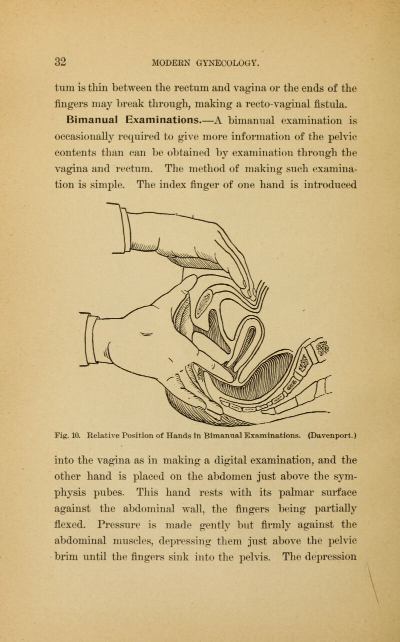 turn is tliin between the rectum and vagina or the ends of the fingers may break through, making a recto-vaginal fistula. Bimanual Examinations.—A bimanual examination is occasionally required to give more information of the pelvic contents than can be obtained by examination through the vagina and rectum. The method of making such examina- tion is simple. The index finger of one hand is introduced Fig. 10. Relative Position of Hands in Bimanual Examinations. (Davenport.) into the vagina as in making a digital examination, and the other hand is placed on the abdomen just above the sym- physis pubes. This hand rests with its palmar surface against the abdominal wall, the fingers being partially flexed. Pressure is made gently but firmly against the abdominal muscles, depressing them just above the pelvic brim until the fingers sink into the pelvis. The depression