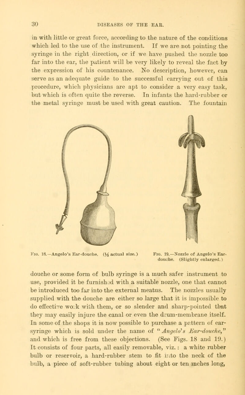 in with little or great force, according to the nature of the conditions which led to the use of the instrument. If we are not pointing the syringe in the right direction, or if we have pushed the nozzle too far into the ear, the patient will be very likely to reveal the fact by the expression of his countenance. No description, however, can serve as an adequate guide to the successful carrying out of this procedure, which physicians are apt to consider a very easy task, but which is often quite the reverse. In infants the hard-rubber or the metal syringe must be used with great caution. The fountain Fig. 18.—Angelo's Ear-douche, (factual size.) Fig. 19.—Nozzle of Angelo's Ear. douche. (Slightly enlarged.) douche or some form of bulb syringe is a much safer instrument to use, provided it be furnished with a suitable nozzle, one that cannot be introduced too far into the external meatus. The nozzles usually supplied with the douche are either so large that it is impossible to do effective work with them, or so slender and sharp-pointed trmt they may easily injure the canal or even the di'um-membrane itself. In some of the shops it is now possible to purchase a pattern of ear- syringe which is sold under the name of Angelo's Ear-douche, and which is free from these objections. (See Figs. 18 and 19.) It consists of four parts, all easily removable, viz.: a white rubber bulb or reservoir, a hard-rubber stem to fit into the neck of the bulb, a piece of soft-rubber tubing about eight or ten inches long,