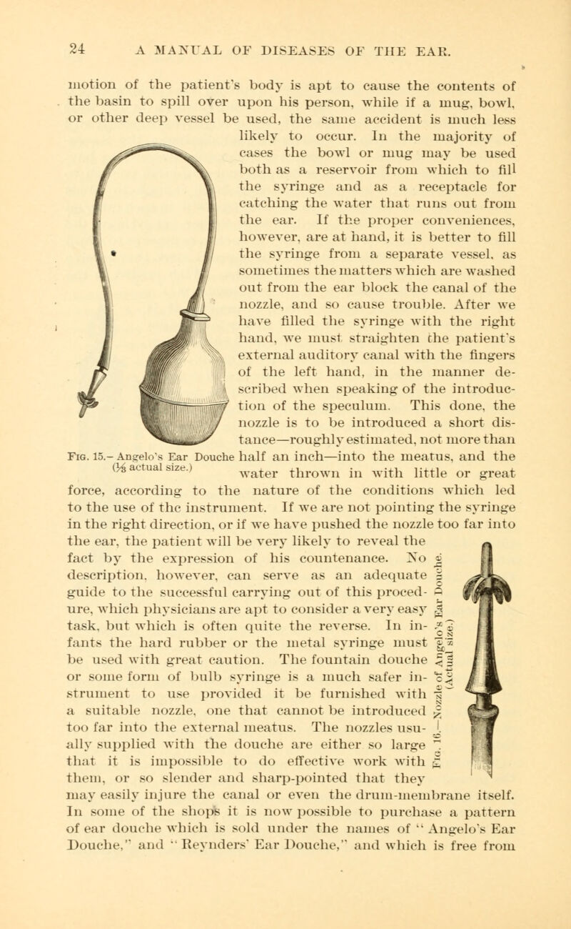 7? motion of the patient's body is apt to cause the contents of the basin to spill over upon his person, while if a mug, bowl, or other deep vessel be used, the same accident is much less likely to occur. In the majority of cases the bowl or mug may be used both as a reservoir from which to fill the syringe and as a receptacle for catching the water that runs out from the ear. If the proper conveniences, however, are at hand, it is better to fill the syringe from a separate vessel, as sometimes the matters which are washed out from the ear block the canal of the nozzle, and so cause trouble. After we have filled the syringe with the right hand, we must straighten die patient's external auditory canal with the fingers of the left hand, in the manner de- j^ scribed when speaking of the introduc- tion of the speculum. This done, the fj nozzle is to be introduced a short dis- tance—roughly estimated, not more than Fig. 15.-Ansrelo's Ear Douche half an inch—into the meatus, and the (H actual size.) wafat thrown in with little or great force, according to the nature of the conditions which led to the use of the instrument. If we are not pointing the syringe in the right direction, or if we have pushed the nozzle too far into the ear, the patient will be very likely to reveal the fact by the expression of his countenance. ]So ® description, however, can serve as an adequate | guide to the successful carrying out of this proced- - ure, which physicians are apt to consider a very easy ^ task, but which is often quite the reverse. In in- £5 fants the hard rubber or the metal syringe must lg* be used with great caution. The fountain douche ^1 or some form of bulb syringe is a much safer in- *= | strument to use provided it be furnished with |N' a suitable nozzle, one that cannot be introduced ^ too far into the external meatus. The nozzles usu- J. ally supplied with the douche are either so large 1 that it is impossible to do effective work with g them, or so slender and sharp-pointed that they may easily injure the canal or even the drum-membrane itself. In some of the shops it is now possible to purchase a pattern of ear douche which is sold under the names of  Angelo's Ear Douche, and Reynders1 Ear Douche, and which is free from
