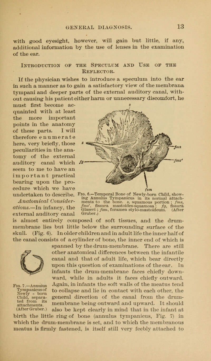 with good eyesight, however, will gain but little, if any, additional information by the use of lenses in the examination of the ear. Introduction of the Speculum and Use of the Reflector. If the physician wishes to introduce a speculum into the ear in such a manner as to gain a satisfactory view of the membrana tympani and deeper parts of the external auditory canal, with- out causing his patient either harm or unnecessary discomfort, he must first become ac- ? quainted with at least the more important points in the anatomy of these parts. I will therefore enumerate here, very briefly, those peculiarities in the ana- tomy of the external auditory canal which seem to me to have an important practical bearing upon the pro- cedure which we have undertaken to describe. Anatomical Consider- ations.—In infancy, the external auditory canal is almost entirely composed of ■fms' fsm Fig. 6.—Temporal Bone of Newly-born Child, show- ing Annulus Tympanicus in its normal attach- ments to the bone. s. squamous portion ; fms, fms'. fissura mastoides-squamosa; fg, fissura Glaseri ; fsm, foramen st3Tlo-mastoideum. (After Gruber.; soft tissues, and the drum- membrane lies but little below the surrounding surface of the skull. (Fig. 6). In older children and in adult life the inner half of the canal consists of a cylinder of bone, the inner end of which is spanned by the drum-membrane. There are still other anatomical differences between the infantile canal and that of adult life, which bear directly upon this question of examinations of the ear. In infants the drum-membrane faces chiefly down- ward, while in adults it faces chiefly outward. Again, in infants the soft walls of the meatus tend to collapse and lie in contact with each other, the general direction of the canal from the drum- membrane being outward and upward. It should also be kept clearly in mind that in the infant at birth the little ring of bone (annulus tympanicus, Fig. 7) in which the drum-membrane is set, and to which the membranous meatus is firmly fastened, is itself still very feebly attached to Fig. 7.—Annulus Tympanicus of Newly - born Child, separa- ted from its attachments. (After Gruber.)