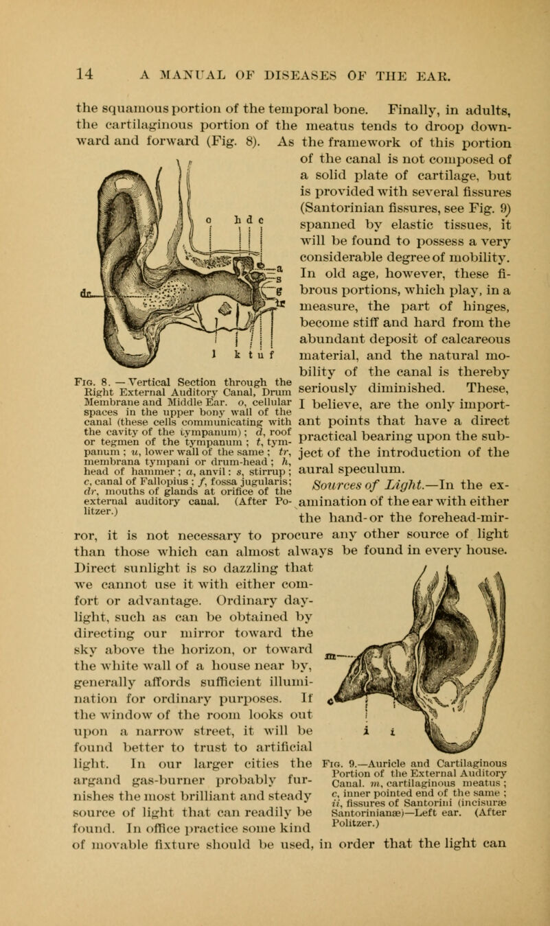 the squamous portion of the temporal bone. Finally, in adults, the cartilaginous portion of the meatus tends to droop down- ward and forward (Fig. 8). As the framework of this portion of the canal is not composed of a solid plate of cartilage, but is provided with several fissures (Santorinian fissures, see Fig. 9) spanned by elastic tissues, it will be found to possess a very considerable degree of mobility. In old age, however, these fi- brous portions, which play, in a measure, the part of hinges, become stiff and hard from the abundant deposit of calcareous material, and the natural mo- bility of the canal is thereby Fig. 8. —Vertical Section through the „_s~„«i_ ^ts^^s^i^u^A mi,n„„ Right External Auditory Canal, Drum seriously diminished. These, Membrane and Middle Ear. o, cellular I believe, are the onlv import- spaces in the upper bony wall of the . -.. canal (these cells communicating with ant points that have a direct the cavity of the tympanum); d, roof ^opti^ol hparino- nnon thp Rub- or tegmen of the tympanum ; t, tym- Poetical Gearing upon ine SUO panum ; u, lower wall of the same ; tr, ject of the introduction of the membrana tympani or drum-head ; h, , , head of hammer; a, anvil: s, stirrup; aural speculum. c canal of Faiiopius; /, fossa juguiaris; Sources of Light—In the ex- dr, mouths of glands at orifice of the ^^ j if external auditory canal. (After Po- animation of the ear with either litzcr ^ the hand-or the forehead-mir- ror, it is not necessary to procure any other source of light than those which can almost always be found in every house. Direct sunlight is so dazzling that Ave cannot use it with either com- fort or advantage. Ordinary day- light, such as can be obtained by directing our mirror toward the sky above the horizon, or toward the white wall of a house near by, generally affords sufficient illumi- nation for ordinary purposes. If the window of the room looks out upon a narrow street, it will be found better to trust to artificial li^rht. In our larger cities the argand gas-burner probably fur- nishes the most brilliant and steady source of li^ht that can readily be found. In office practice some kind of movable fixture should be used, in order that the light can Fio. 9.—Auricle and Cartilaginous Portion of the External Auditory Canal, m, cartilaginous meatus ; c, inner pointed end of the same ; ii, fissures of Santorini (incisures Santorinianae)—Left ear. (After Politzer.)