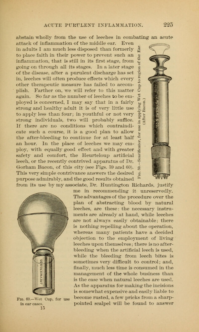 „.... abstain wholly from the use of leeches in combating an acute attack of inflammation of the middle ear. Even in adults I am much less disposed than formerly to place faith in their power to prevent such an inflammation, that is still in its first stage, from going on through all its stages. In a later stage of the disease, after a purulent discharge has set in. leeches will often produce effects which every other therapeutic measure has failed to accom- plish. Farther on. we will refer to this matter again. So far as the number of leeches to be em- ployed is concerned. I may say that in a fairly strong and healthy adult it is of very little use = | to apply less than four; in youthful or not very g -T strong individuals, two will probably suffice. = *i If there are no conditions which contraindi- g cate such a course, it is a good plan to allow Z the after-bleeding to continue for at least half 1 an hour. In the place of leeches Ave may em- i ploy, with equally good effect and with greater | safety and comfort, the Heurteloup artificial % leech, or the recently contrived apparatus of Dr. ■? Gorham Bacon, of this city (see Figs. 59 and 60). g This very simple contrivance answers the desired z purpose admirably, and the good results obtained ~ from its use by my associate. Dr. Huntington Richards, justify me in recommending it unreservedly. The advantages of the procedure over the plan of abstracting blood by natural leeches, are these: the necessary instru- ments are already at hand, while leeches are not always easily obtainable: there is nothing repelling about the operation, whereas many patients have a decided objection to the employment of living leeches upon themselves; there is no after- bleeding when the artificial leech is used, while the bleeding from leech bites is sometimes very difficult to control; and, finally, much less time is consumed in the management of the whole business than is the case when natural leeches are used. As the apparatus for making the incisions is somewhat expensive and easily liable to become rusted, a few pricks from a sharp- pointed scalpel will be found to answer Fig. 60.—Wet Cup, for use in ear ease>. 15