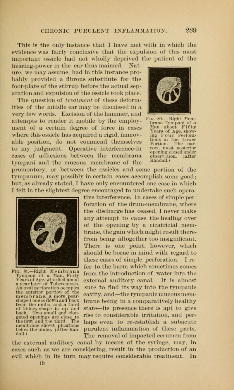 Fig. 80. —Right Mem- brana Tympani of a Man about Fifty Years of Age, show- ing Four Perfora- tions in the Lower Portion. The nar- row, most posterior opening.closed under observation. t, After Randall.) This is the only instance that I have met with in which the evidence was fairly conclusive that the expulsion of this most important ossicle had not wholly deprived the patient of the hearing-power in the ear thus maimed. Nat- ure, we may assume, had in this instance pro- bably provided a fibrous substitute for the foot-plate of the stirrup before the actual sep- aration and expulsion of the ossicle took place. The question of treatment of these deform- ities of the middle ear may be dismissed in a very few words. Excision of the hammer, and attempts to render it mobile by the employ- ment of a certain degree of force in cases where this ossicle has acquired a rigid, immov- able position, do not commend themselves to my judgment. Operative interference in cases of adhesions between the membrana tympani and the mucous membrane of the promontory, or between the ossicles and some portion of the tympanum, may possibly in certain cases accomplish some good; but, as already stated, I have only encountered one case in which I felt in the slightest degree encouraged to undertake such opera- tive interference. In cases of simple per- foration of the drum-membrane, where the discharge has ceased, I never make any attempt to cause the healing over of the opening by a cicatricial mem- brane, the gain which might result there- from being altogether too insignificant. There is one point, however, which should be borne in mind with regard to these cases of simple perforation. I re- fer to the harm which sometimes comes from the introduction of water into the external auditory canal. It is almost sure to find its way into the tympanic cavity, and—the tympanic mucous mem- brane being in a comparatively healthy state—its presence there is apt to give rise to considerable irritation, and per- haps even to re-establish a subacute purulent inflammation of these parts. The removal of impacted cerumen from the external auditory canal by means of the syringe, may, in cases such as we are considering, result in the production of an evil which in its turn may require considerable treatment. In 19 Fig. 81.—Right Membrana Tympani of a Man, Forty Years of Age. who died about a year later of Tuberculosis. An oval perforation occupies the anterior portion of the membrane, a more pear- shaped one is down and back from the umbo, and a third of kidney-shape is up «nd back. Two small and elon- gated openings are close to the first and the third. The membrane shows plications below the umbo. (After Ran- dall.)