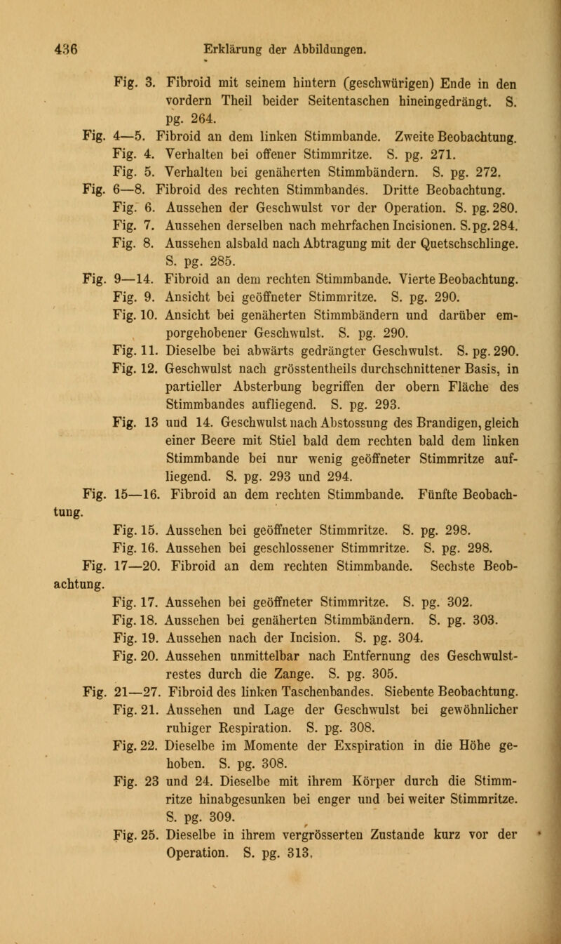 Fig. 3. Fibroid mit seinem hiutern (geschwiirigen) Ende in den vordern Theil beider Seitentaschen hineingedrangt. S. pg. 264. Fig. 4—5. Fibroid an dem linken Stimmbande. Zweite Beobachtung. Fig. 4. Verhalten bei offener Stimmritze. S. pg. 271. Fig. 5. Verhalten bei genaherten Stimmbandern. S. pg. 272. Fig. 6—8. Fibroid des rechten Stimmbandes. Dritte Beobachtung. Fig. 6. Aussehen der Geschwulst vor der Operation. S. pg. 280. Fig. 7. Aussehen derselben nach mehrfachen Incisionen. S.pg.284. Fig. 8. Aussehen alsbald nach Abtragung mit der Quetschschlinge. S. pg. 285. Fig. 9—14. Fibroid an dem rechten Stimmbande. Vierte Beobachtung. Fig. 9. Ansicht bei geoffneter Stimmritze. S. pg. 290. Fig. 10. Ansicht bei genaherten Stimmbandern und daruber em- porgehobener Geschwulst. S. pg. 290. Fig. 11. Dieselbe bei abwarts gedrangter Geschwulst. S. pg. 290. Fig. 12. Geschwulst nach grosstentheils durchschnittener Basis, in partieller Absterbung begriffen der obern Flache des Stimmbandes aufliegend. S. pg. 293. Fig. 13 und 14. Geschwulst nach Abstossung des Brandigen, gleich einer Beere mit Stiel bald dem rechten bald dem linken Stimmbande bei nur wenig geoffneter Stimmritze auf- liegend. S. pg. 293 und 294. Fig. 15—16. Fibroid an dem rechten Stimmbande. Funfte Beobach- tung. Fig. 15. Aussehen bei geoffneter Stimmritze. S. pg. 298. Fig. 16. Aussehen bei geschlossener Stimmritze. S. pg. 298. Fig. 17—20. Fibroid an dem rechten Stimmbande. Sechste Beob- achtung. Fig. 17. Aussehen bei geoffneter Stimmritze. S. pg. 302. Fig. 18. Aussehen bei genaherten Stimmbandern. S. pg. 303. Fig. 19. Aussehen nach der Incision. S. pg. 304. Fig. 20. Aussehen unmittelbar nach Entfernung des Geschwulst- restes durch die Zange. S. pg. 305. Fig. 21—27. Fibroid des linken Taschenbandes. Siebente Beobachtung. Fig. 21. Aussehen und Lage der Geschwulst bei gewohnlicher ruhiger Respiration. S. pg. 308. Fig. 22. Dieselbe im Momente der Exspiration in die Hohe ge- hoben. S. pg. 308. Fig. 23 und 24. Dieselbe mit ihrem Korper durch die Stimm- ritze hinabgesunken bei enger und bei weiter Stimmritze. S. pg. 309. Fig. 25. Dieselbe in ihrem vergrosserten Zustande kurz vor der Operation. S. pg. 313.