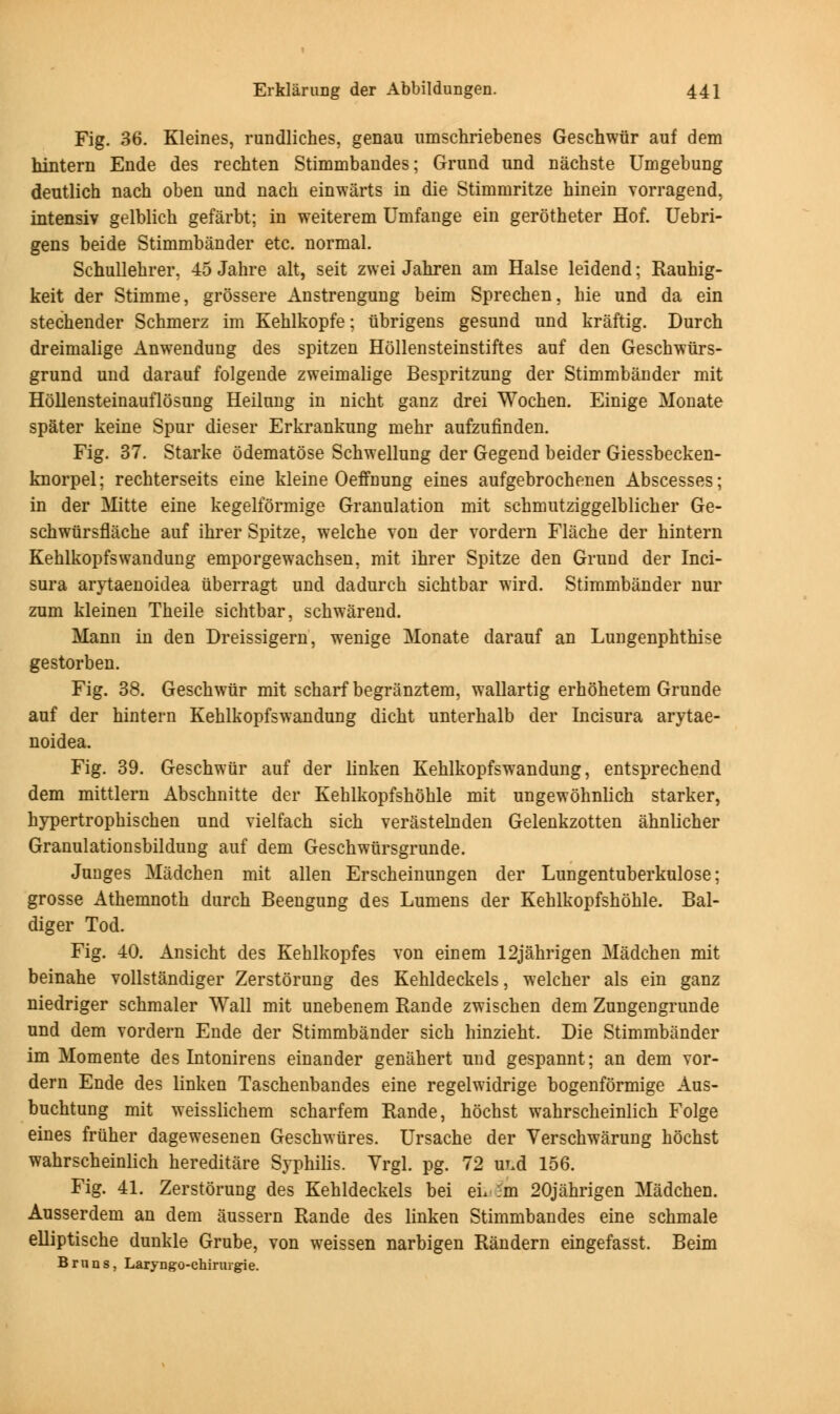 Fig. 36. Kleines, rundliches, genau umschriebenes Geschwur auf dem hintern Ende des rechten Stimmbandes; Grund und nachste Umgebung deutlich nach oben und nach einwarts in die Stimniritze hinein vorragend, intensiv gelblich gefarbt; in weiterem Umfange ein gerotheter Hof. Uebri- gens beide Stimmbander etc. normal. Schullehrer, 45 Jahre alt, seit zwei Jahren am Halse leidend; Rauhig- keit der Stimme, grossere Anstrengung beim Sprechen, bie und da ein stechender Schmerz im Keblkopfe; iibrigens gesund und kraftig. Durch dreimalige Anwendung des spitzen Hollensteinstiftes auf den Geschwurs- grund und darauf folgende zweimalige Bespritzung der Stimmbander mit Hollensteinauflosung Heilnng in nicht ganz drei Wochen. Einige Monate spater keine Spur dieser Erkrankung mehr aufzufinden. Fig. 37. Starke odematose Schwellung der Gegend beider Giessbecken- knorpel; recbterseits eine kleine Oeffnung eines aufgebrochenen Abscesses; in der Mitte eine kegelformige Granulation mit scbmutziggelblicber Ge- schwiirsflache auf ibrer Spitze, welcbe von der vordern Flacbe der bintern Kehlkopfswandung emporgewacbsen, mit ibrer Spitze den Grund der Inci- sura arytaenoidea iiberragt und dadurch sichtbar wird. Stimmbander nur zum kleinen Theile sichtbar, schwarend. Mann in den Dreissigern, wenige Monate darauf an Lungenphthise gestorben. Fig. 38. Geschwiir mit scbarf begriinztem, wallartig erhohetem Grunde auf der bintern Keblkopfswandung dicbt unterbalb der Incisura arytae- noidea. Fig. 39. Geschwur auf der linken Kehlkopfswandung, entsprechend dem mittlern Abschnitte der Kehlkopfshoble mit ungewolmlich starker, hypertrophischen und vielfach sich verastelnden Gelenkzotten ahnlicher Granulationsbildung auf dem Geschwiirsgrunde. Junges Madchen mit alien Erscheinungen der Lungentuberkulose; grosse Athemnoth durch Beengung des Lumens der Kehlkopfshoble. Bal- diger Tod. Fig. 40. Ansicht des Kehlkopfes von einem 12jahrigen Madchen mit beinahe vollstandiger Zerstorung des Kehldeckels, welcher als ein ganz niedriger schmaler Wall mit unebenem Rande zwischen dem Zungengrunde und dem vordern Ende der Stimmbander sich hinzieht. Die Stimmbander im Momente des Intonirens einander genahert und gespannt; an dem vor- dern Ende des linken Taschenbandes eine regelwidrige bogenformige Aus- buchtung mit weisslichem scharfem Rande, hochst wahrscheinlich Folge eines fruher dagewesenen Geschwiires. Ursache der Verschwarung hochst wahrscheinlich hereditare Syphilis. Vrgl. pg. 72 ur.d 156. Fig. 41. Zerstorung des Kehldeckels bei ei, 5m 20jahrigen Madchen. Ausserdem an dem aussern Rande des linken Stimmbandes eine schmale elliptische dunkle Grube, von weissen narbigen Randern eingefasst. Beim Brnns, Laryngo-chirurgie.