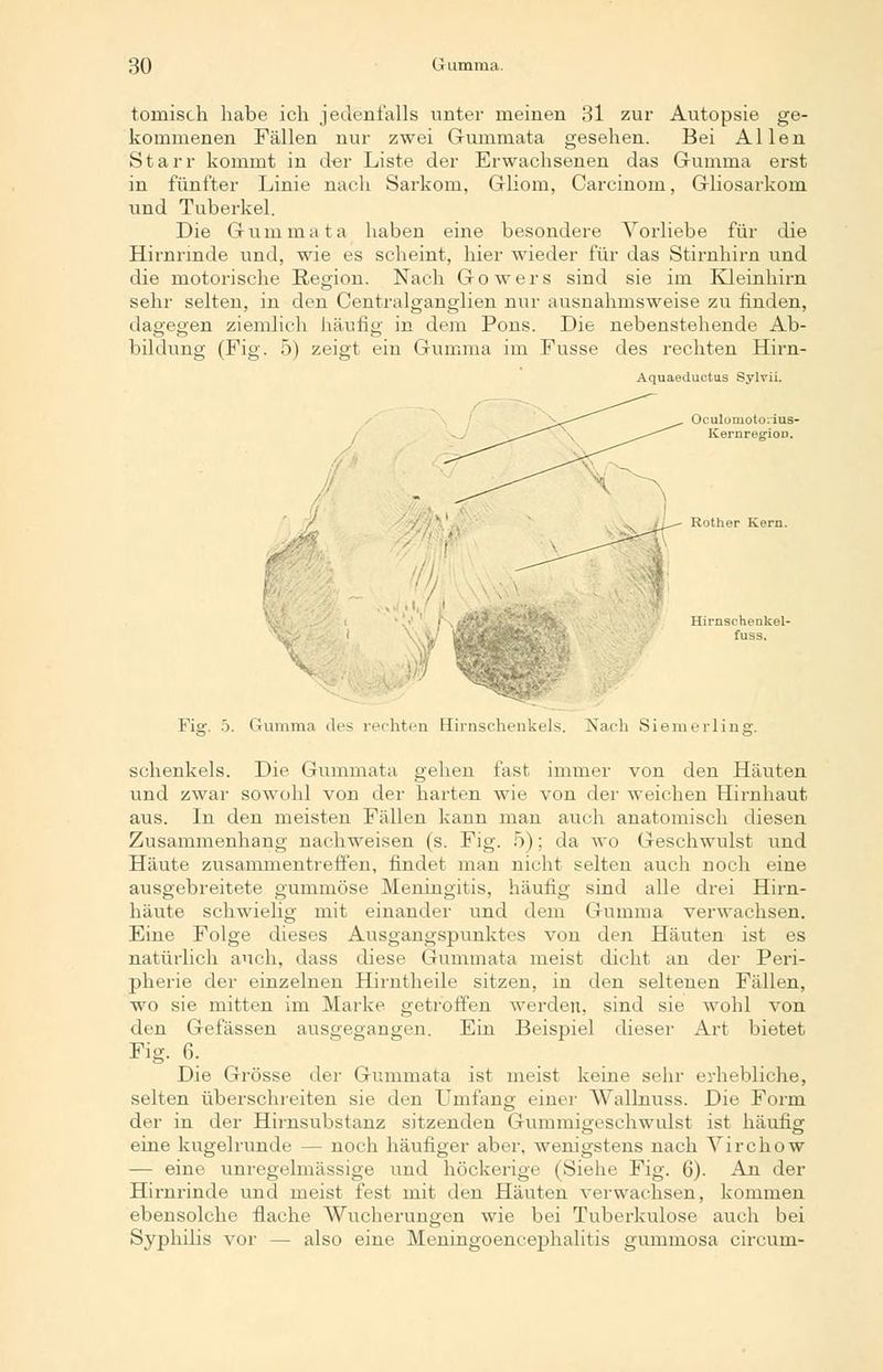 tomisch habe ich jedenfalls unter meinen 31 zur Autopsie ge- kommenen Fällen nur zwei Gmnmata gesehen. Bei Allen Starr kommt in der Liste der Erwachsenen das Gumma erst in fünfter Linie nach Sarkom, Gliom, Carcinoin, Gliosarkom und Tuberkel. Die Gummata haben eine besondere Vorliebe für die Hirnrinde und, wie es scheint, hier wieder für das Stirnhirn und die motorische Region. Nach Gowers sind sie im Kleinhirn sehr selten, in den Oentralganglien nur ausnahmsweise zu finden, dagegen ziemlich häufig in dem Pons. Die nebenstehende Ab- bildung (Fig. 5) zeigt ein Gumma im Fusse des rechten Hirn- Aquaeductus Sylvii. Oculoniotorius- KernregioD. Rother Kern. Hirnschenkel- fuss. Fia;. ö. Duiuma des :hten Elirnschenkels. Nach Siemerlins. schenkeis. Die Gummata gehen fast immer von den Häuten und zwar sowohl von der harten wie von der weichen Hirnhaut aus. In den meisten Fällen kann man auch anatomisch diesen Zusammenhang nachweisen (s. Fig. 5); da wo Geschwulst und Häute zusammentreffen, findet man nicht selten auch noch eine ausgebreitete gummöse Meningitis, häufig sind alle drei Hirn- häute schwielig mit einander und dem Gumma verwachsen. Eine Folge dieses Ausgangspunktes von den Häuten ist es natürlich auch, dass diese Gummata meist dicht an der Peri- pherie der einzelnen Hirntheile sitzen, in den seltenen Fällen, wo sie mitten im Marke getroffen werden, sind sie wohl von den Gefässen ausgegangen. Ein Beispiel dieser Art bietet Fi§- 6: Die Grösse der Gummata ist meist keine sehr erhebliche, selten überschreiten sie den Umfang einer Wallnuss. Die Form der in der Hirnsubstanz sitzenden Gummigeschwulst ist häufig eine kugelrunde — noch häufiger aber, wenigstens nach Yirchow — eine unregelmässige und höckerige (Siehe Fig. 6). An der Hirnrinde und meist fest mit den Häuten verwachsen, kommen ebensolche flache Wucherungen wie bei Tuberkulose auch bei Syphilis vor — also eine Meningoencephalitis gummosa circum-