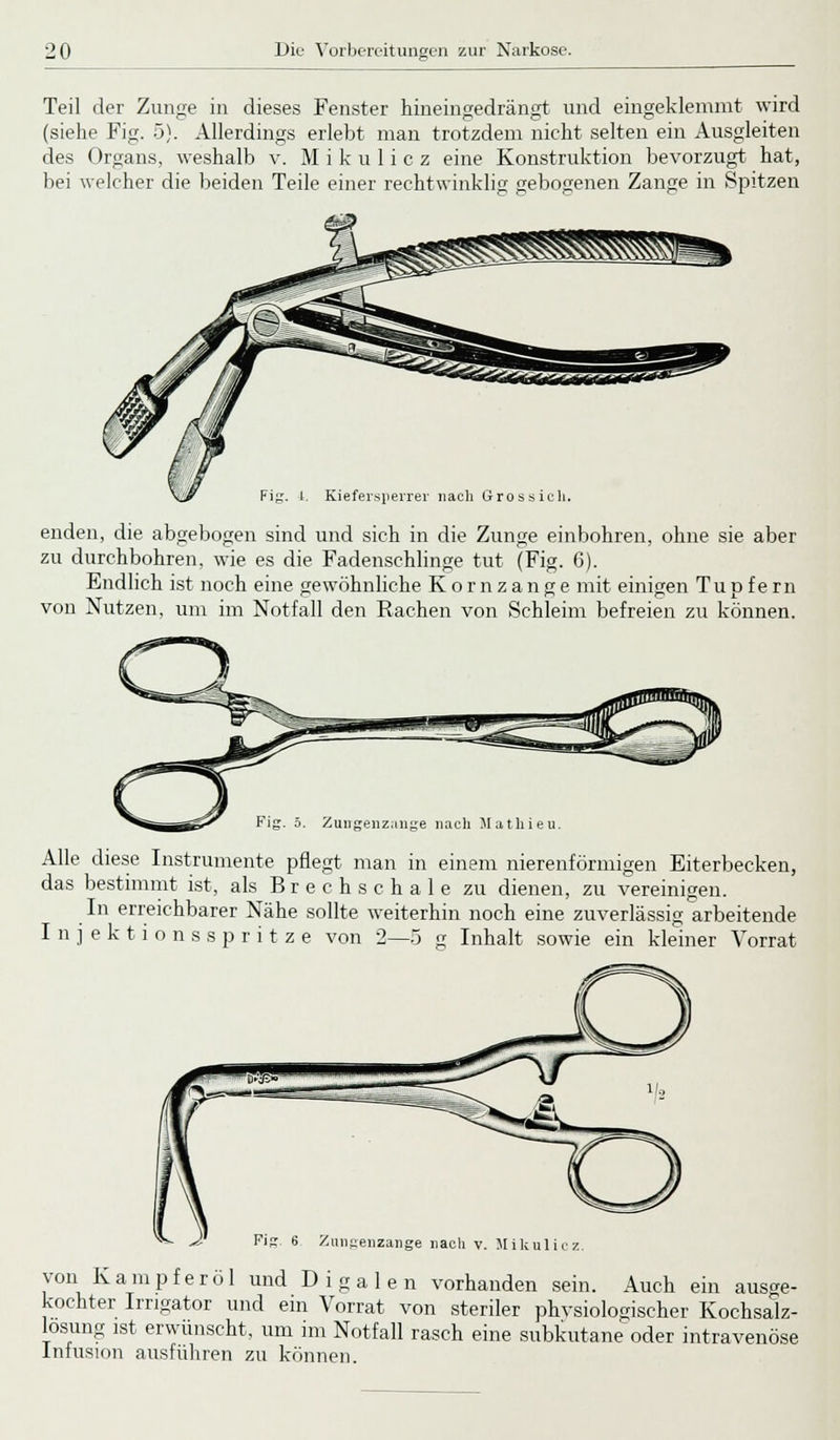Teil der Zunge in dieses Fenster hineingedrängt und eingeklemmt wird (siehe Fig. 5). Allerdings erlebt man trotzdem nicht selten ein Ausgleiten des Organs, weshalb v. Mikulicz eine Konstruktion bevorzugt hat, bei welcher die beiden Teile einer rechtwinklig gebogenen Zange in Spitzen Kiefersperrer nach Gros sich. enden, die abgebogen sind und sich in die Zunge einbohren, ohne sie aber zu durchbohren, wie es die Fadenschlinge tut (Fig. 6). Endlich ist noch eine gewöhnliche Kornzange mit einirren Tuofern AT A von Mutzen, um im Notfall den Rachen von Schleim befreien zu können. Zuirgenzange nach Mathieu. Alle diese Instrumente pflegt man in einem nierenförmigen Eiterbecken, das bestimmt ist, als Brechschale zu dienen, zu vereinigen. In erreichbarer Nähe sollte weiterhin noch eine zuverlässig arbeitende Injektionsspritze von 2—5 g Inhalt sowie ein kleiner Vorrat Zun^enzange nach v. Mikulic von Kampferöl und Digalen vorhanden sein. Auch ein ausge- kochter Irrigator und ein Vorrat von steriler physiologischer Kochsalz- losung ist erwünscht, um im Notfall rasch eine subkutane oder intravenöse Infusion ausführen zu können.