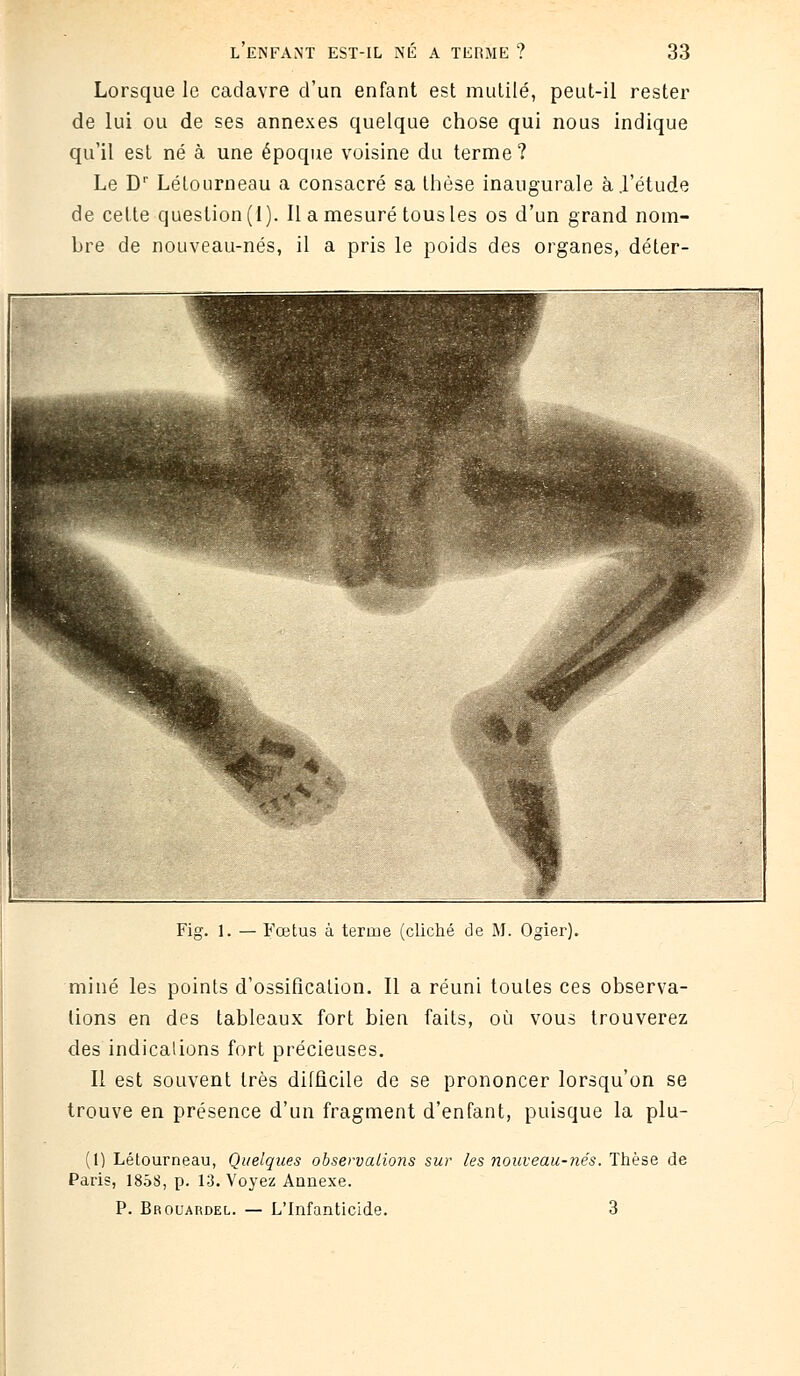 Lorsque le cadavre d'un enfant est mutilé, peut-il rester de lui ou de ses annexes quelque chose qui nous indique qu'il est né à une époque voisine du terme? Le Dr Lélourneau a consacré sa thèse inaugurale à.l'étude de cette question (1). Il a mesuré tous les os d'un grand nom- bre de nouveau-nés, il a pris le poids des organes, déter- Fig. 1. — Fœtus à terme (cliché de M. Ogier). miné les points d'ossification. Il a réuni toules ces observa- tions en des tableaux fort bien faits, où vous trouverez des indicalions fort précieuses. Il est souvent très difficile de se prononcer lorsqu'on se trouve en présence d'un fragment d'enfant, puisque la plu- (1) Létourneau, Quelques observations sur les nouveau-nés. Thèse de Paris, 1858, p. 13. Voyez Annexe. P. Brouardel. — L'Infanticide. 3