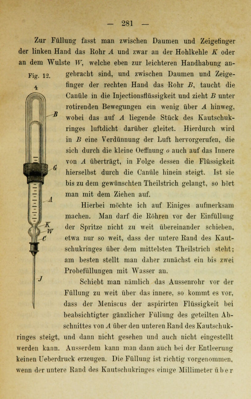 Zur Füllung fasst man zwischen Daumen und Zeigefinger der linken Hand das Rohr A und zwar an der Hohlkehle K oder an dem Wulste W, welche eben zur leichteren Handhabung an- Fig. 12. gebracht sind, und zwischen Daumen und Zeige- ^ finger der rechten Hand das Rohr B, taucht die Canüle in die Injectionsflüssigkeit und zieht B unter rotirenden Bewegungen ein wenig über A hinweg. l-S wobei das auf A liegende Stück des Kautschuk- - ringes luftdicht darüber gleitet. Hierdurch wird in B eine Verdünnung der Luft hervorgerufen, die sich durch die kleine Oelfnung o auch auf das Innere von A überträgt, in Folge dessen die Flüssigkeit hierselbst durch die Canüle hinein steigt. Ist sie bis zu dein gewünschten Theilstrich gelangt, so hört man mit dem Ziehen auf. Hierbei möchte ich auf Einiges aufmerksam machen. Man darf die Röhren vor der Einfüllung der Spritze nicht zu weit übereinander schieben, etwa nur so weit, dass der untere Rand des Kaut- schukringes über dem mittelsten Theilstrich steht; am besten stellt man daher zunächst ein bis zwei Probefüllungen mit Wasser au. Schiebt man nämlich das Aussenrohr vor der Füllung zu weit über das innere, so kommt es vor, dass der Meniscus der aspirirten Flüssigkeit bei beabsichtigter gänzlicher Füllung des geteilten Ab- schnittes von A über den unteren Rand des Kautsch uk- ringes steigt, und dann nicht gesehen und auch nicht eingestellt werden kann. Ausserdem kann man dann auch bei der Entleerung keinen Ueberdruck erzeugen. Die Füllung ist richtig vorgenommen, wenn der untere Rand des Kautschukringes einige Millimeter üb e r