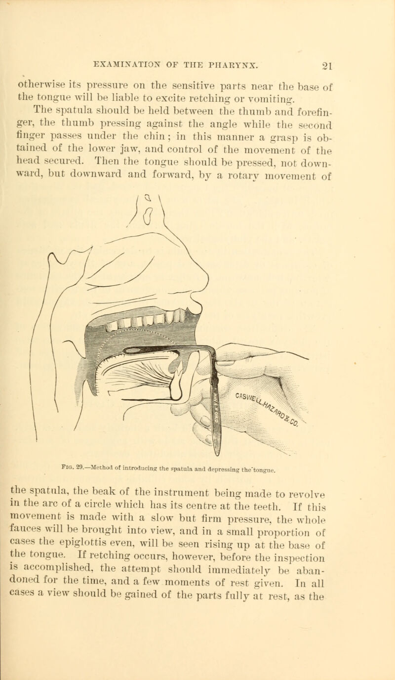 otherwise its pressure on the sensitive parts near the base of the tongue will be liable to excite retching or vomiting. The spatula should be held between the thumb and forefin- ger, the thumb pressing against the angle while the second finger passes under the chin; in this manner a grasp is ob- tained of the lower jaw. and control of the movement of the head secured. Then the tongue should be pressed, not down- ward, but downward and forward, by a rotary movement of Fig. 29.—Method of introducing the spatula and depressing the'tongue. the spatula, the beak of the instrument being made to revolve in the arc of a circle which has its centre at the teeth. If this movement is made with a slow but firm pressure, the whole fauces will be brought into view, and in a small proportion of cases the epiglottis even, will be seen rising up at the base of the tongue. If retching occurs, however, before the inspection is accomplished, the attempt should immediately be aban- doned for the time, and a few moments of rest given. In all cases a view should be gained of the parts fully at rest, as the