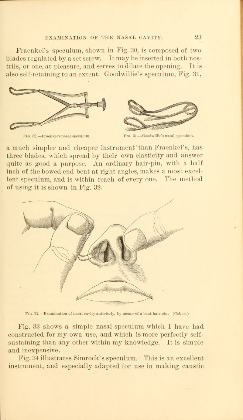 Fraenkel's speculum, shown in Fig. 30, is composed of two blades regulated by a set screw. It may be inserted in both nos- trils, or one, at pleasure, and serves to dilate the opening. It is also self-retaining to an extent. Goodwillie's speculum, Fig. 31, Fig. 30.—Fraenkel's nasal speculum. Fig. 31.—Goodwillie's nasal speculum. a much simpler and cheaper instrumentNthan Fraenkel's, has three blades, which spread by their own elasticity and answer quite as good a purpose. An ordinary hair-pin, with a half inch of the bowed end bent at right angles, makes a most excel- lent speculum, and is within reach of every one. The method of using it is shown in Fig. 32. Fig. 32.—Examination of nasal cavity anteriorly, by means of a bent hair-pin. (Cohen.) Fig. 33 shows a simple nasal speculum which I have had constructed for my own use, and which is more perfectly self- sustaining than any other within my knowledge. It is simple and inexpensive. Fig. 34 illustrates Simrocks speculum. This is an excellent instrument, and especially adapted for use in making caustic