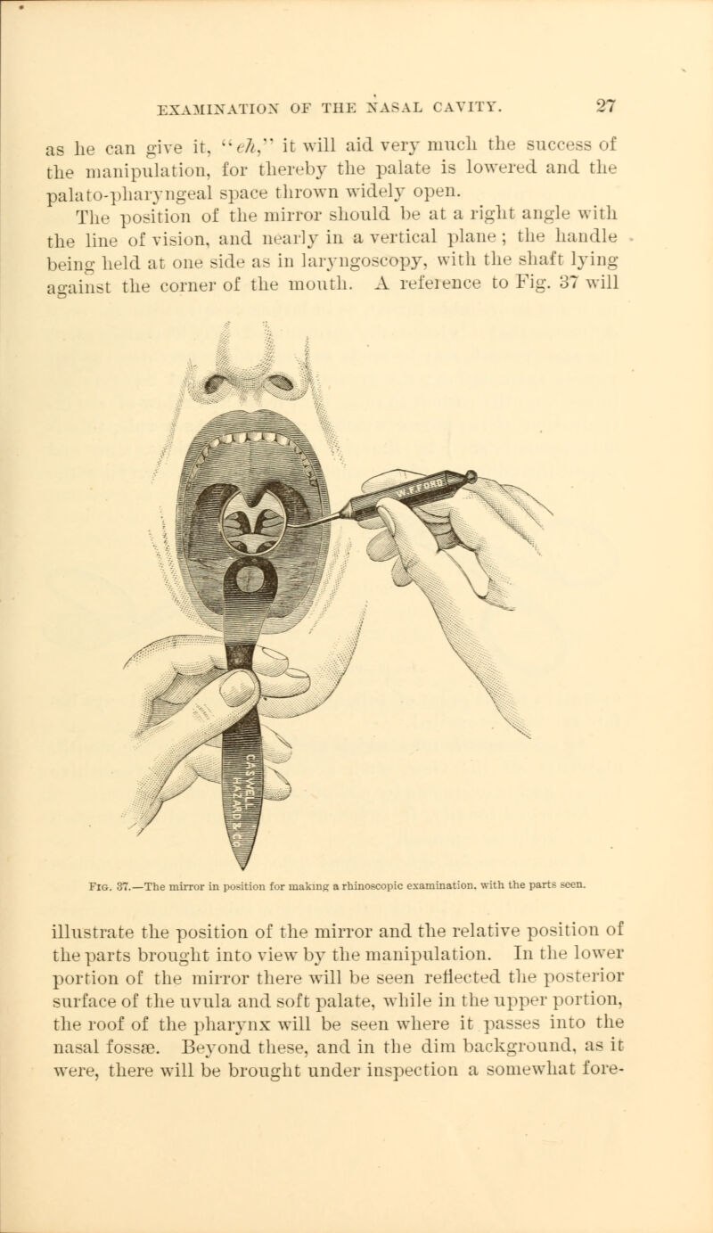 as he can give it, eA, it will aid very much the success of the manipulation, for thereby the palate is lowered and the palatopharyngeal space thrown widely open. The position of the mirror should be at a right angle with the line of vision, and nearly in a vertical plane ; the handle being held at one side as in laryngoscopy, with the shaft lying against the corner of the mouth. A refeience to Fig. 3? will Fig. 37.—The mirror in position for making arhinoscopic examination, with the parts seen. illustrate the position of the mirror and the relative position of the parts brought into view by the manipulation. In the lower portion of the mirror there will be seen reflected the posterior surface of the uvula and soft palate, while in the upper portion, the roof of the pharynx will be seen where it p»asses into the nasal fossae. Beyond these, and in the dim background, aa ir were, there will be brought under inspection a somewhat fore-