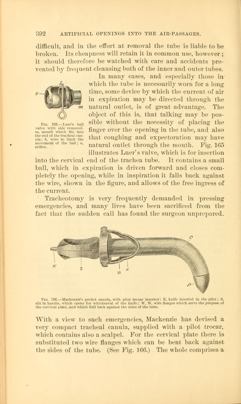 difficult, and in the effort at removal the tube is liable to be broken. Its cheapness will retain it in common use, however ; it should therefore be watched with care and accidents pre- vented by frequent cleansing both of the inner and outer tubes. In many cases, and especially those in which the tube is necessarily worn for a long time, some device by which the current of air in expiration may be directed through the natural outlet, is of great advantage. The object of this is, that talking may be pos- sible without the necessity of placing the finger over the opening in the tube, and also that coughing and expectoration may have natural outlet through the mouth. Fig. 165 illustrates Luer's valve, which is for insertion into the cervical end of the trachea tube. It contains a small ball, which in expiration is driven forward and closes com- pletely the opening, while in inspiration it falls back against the wire, shown in the figure, and allows of the free ingress of the current. Tracheotomy is very frequently demanded in pressing emergencies, and many lives have been sacrificed from the fact that the sudden call has found the surgeon unprepared. Fig. 165.—Luer's ball valve with side removed. m. mouth which fits into the end of the tracheal can- ula: &, wire to limit the movement of the ball; o, orifice. Fig. 10(5.—Mackenzie's pocket cannla, with pilot trccar inserted: K, knife inserted in the pilot; S, slit in handle, which opens for withdrawal of the knife; W, W. wire flanges which serve the purpose of the cervical plate, and which fold back against the sides of the tube. With a view to such emergencies, Mackenzie has devised a very compact tracheal canula, supplied with a pilot trocar, which contains also a scalpel. For the cervical plate there is substituted two wire flanges which can be bent back against the sides of the tube. (See Fig. 166.) The whole comprises a