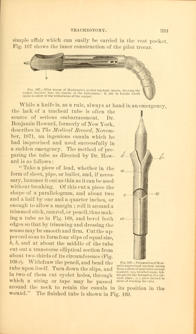 simple affair which can easily be carried in the vest pocket. Fig. 167 shows the inner construction of the pilot trocar. Fig. 16..—Mot trocar of Mackenzie's pocket tracheal carmla, show-in? the scalpel inserted into the handle of the instrument : S, slit in handle which opens to allow of the withdrawal of the scalpel. While a knife is, as a rule, always at hand in an emergency, the lack of a tracheal tube is often the source of serious embarrassment. Dr. Benjamin Howard, formerly of New York, describes in The Medical Record, Novem- ber, 1871, an ingenious carmla which he had improvised and used successfully in a sudden emergency. The method of pre- paring the tube as directed by Dr. How- ard is as follows:  Take a piece of lead, whether in the form of sheet, pipe, or bullet, and, if neces- sary, hammer it out as thin as it can be used without-breaking. Of this cut a piece the shape of a parallelogram, and about two and a half by one and a quarter inches, or enough to allow a margin ; roll it around a trimmed stick, ramrod, or pencil, thus mak- ing a tube as in Fig. 1G8, and bevel both edges so that by trimming and dressing the seams may be smooth and firm. Cut the up- per end so as to form four slips of equal size, b, b, and at about the middle of the tube cut out a transverse elliptical section from about two-thirds of its circumference (Pig. 168 c). Withdraw the pencil, and bend the ,-i ., in m -. ■,,. , »ra b ; improvised cracneai canuia tllbe Upon ltSelt. llirn down the Slips, and from a Bheet of lead rolled around , - , -i -i , a pencil: a,a, bevelled seam; 6,6, 111 tWO 01 tliem CUt eyelet holes, thrOU°'h flanges for the formation of a cer- 1 . 1 . ' ° vical plate ; <■, c, piece Incised to wincli a string or tape may be passed aUnw'of Ending the tube, around the neck to retain the canula in its position in the wound. The finished tube is shown in Fig. 169. cv- FlG. 168.—Preparationof How- ard's improvisi d tracheal canula