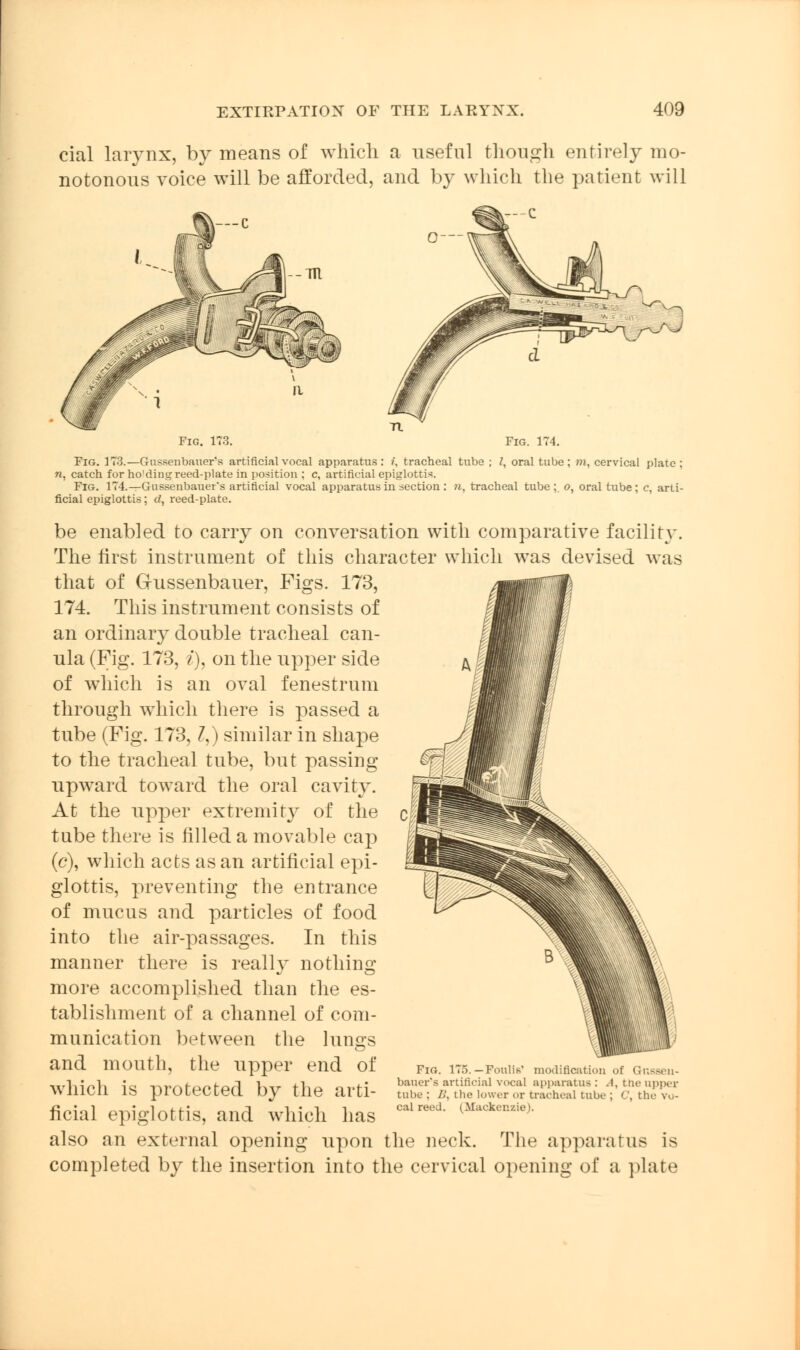 cial larynx, by means of which a useful though entirely mo- notonous voice will be afforded, and by which the patient will Fig. 173. Fig. 11 Fig. 173.—Gussenbauer's artificial vocal apparatus: i. tracheal tube; I, oral tube; m, cervical plate; n. catch for ho'ding reed-plate in position ; c, artificial epiglottic Fig. 174.—Gussenbauer's artificial vocal apparatus in section : n, tracheal tube ;. o, oral tube ; c, arti- ficial epiglottis; d, reed-plate. be enabled to carry on conversation with comparative facility. The first instrument of this character which was devised was that of Gussenbauer, Figs. 173, 174. This instrument consists of an ordinary double tracheal can- ula (Fig. 173, /), on the upper side of which is an oval fenestrum through which there is passed a tube (Fig. 173,1,) similar in shape to the tracheal tube, but passing upward toward the oral cavity. At the upper extremity of the tube there is filled a movable cap (c), which acts as an artificial epi- glottis, preventing the entrance of mucus and particles of food into the air-passages. In this manner there is really nothing more accomplished than the es- tablishment of a channel of com- munication between the lungs and mouth, the upper end of which is protected by the arti- ficial epiglottis, and which has also an external opening upon the neck. The apparatus is completed by the insertion into the cervical opening of a plate Fig. 175.—Foulis' modification of Q-nsseu- bauer's artificial vocal apparatus : .1. the upper tube ; Z>, the lower or tracheal tube ; <\ the vu- cal reed. (Mackenzie).