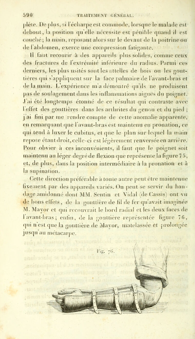 plète. De plus, si l'écliarpeest commode, lorsque le malade est debout, la position quelle nécessite est pénible quand il est couclié; la main, reposant alors sur le devant de la poitrine ou de l'abdomen, exerce une compression fatigante. Il faut recourir à des appareils plus solides, comme ceux des fractures de fextrémitë inférieure du radius. Parmi ces derniers, les plus usités sont les attelies de bois ou les gout- tières qui s'appliquent sur la face palmaire de lavant-bras et de la main. L'expérience m'a démontre qu'ils ne produisent pas de soulagement dans les inflammations aiguës du poignet. J'ai été longtemps étonné de ce résultat qui contraste avec l'effet des gouttières dans les arthrites du genou et du pied ; j ai fini par me rendre compte de cette anomalie apparente, en remarquant que lavant-bras est maintenu en pronation, ce qui tend à luxer le cubitus, et que le plan sur lequel la main repose étantdroit,celle-ci est légèrement renversée en arrière. Pour obvier à ces inconvénients, il faut (pie le poignet soit maintenu au léger degré de flexion que représente la figure 7 5-, et, de plus, dans la position intermédiaire à la pronation et à la supination. Cette direction préférable à toute autre peut être maintenue fixement par des appareils variés. On peut se servir du ban- dage amidonné dont MM. Senti n et Vidal (de Cassis) ont vu de bons effets , de la gouttière de fil de fer qu'avait imaginée M. Mayor et qui recouvrait le bord radial et les deux faces de lavant-bras; enfin, de la gouttière représentée figure 76, qui n'est que la gouttière de Mayor, matelassée et prolongée jusqu'au métacarpe.