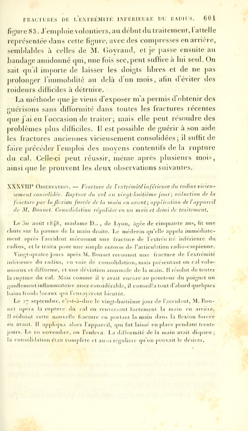 figure 83. J'emploie volontiers, au début du traitement, l'attelle représentée dans cette figure, avec des compresses en arrière, semblables à celles de M. Goyrand, et je passe ensuite au bandage amidonné qui, une fois sec, peut suffire à lui seul. On sait qu'il importe de laisser les doigts libres et de ne pas prolonger l'immobilité au delà d'un mois, afin d'éviter des roidenrs difficiles à détruire. La méthode que je viens d'exposer m'a permis d'obtenir des guérisons sans difformité dans tontes les fractures récentes (jLie j'ai eu l'occasion de traiter; mais elle peut résoudre des problèmes plus difficiles. Il est possible de guérir à son aide les fractures anciennes vicieusement consolidées; il suffit de faire précéder l'emploi des moyens contentils de la rupture du cal. Celle-ci peut réussir, même après plusieurs mois, ainsi une le prouvent les deux observations suivantes. XXXVIIIe Observation. — Fracture de [extrémitéinférieure du radius vicieu- sement consolidée. Rupture du col au vingt-huitième jour ; réduction de la fracture par lajlexion forcée de la main en avant; application de l'appareil de M. Bonnet. Consolidation régulière en un mois et demi de traitement. Le 3o août 1848, madame D.. , de Lyon, àyée de cinquante ans, fit une chute sur la paume de la main droite. Le médecin qu'elle appela immédiate- ment après l'accident méconnut une fracture de l'extrén ité inférieure du radius, et la traita pour une simple entorse de l'articulation radio-carpienne. Vingt-quatre jours après M. Bonnet reconnut une fracture de l'extrémité inférieure du radius, en voie de consolidation, mais présentant un cal volu- mineux et difforme, et une déviation anormale de la main. Il résolut de tenter la rupture du cal. Mais comme il v avait encore au pourtour du poignet un gonflement inflammatoire assez considérable, il conseilla tout d'abord quelques bains froids locaux qui l'enrayèrent bientôt. Le 27 septembre, c'est-à-dire le vingt-huitième jour de l'accident, M. Bon- net opéra la rupture du cal en renversant fortement la m.un en arrière. Il réduisit cette nouvelle fiacture en portant la main dans la Hexion forcée en avant. Il appliqua alors l'appareil, qui fut laissé en place pendant Iicnte jours. Le 10 novembre, on l'enleva. La difformité de la main avait disparu ; la consolidation était complète et aussi régulière qu'on pouvait le désirer.