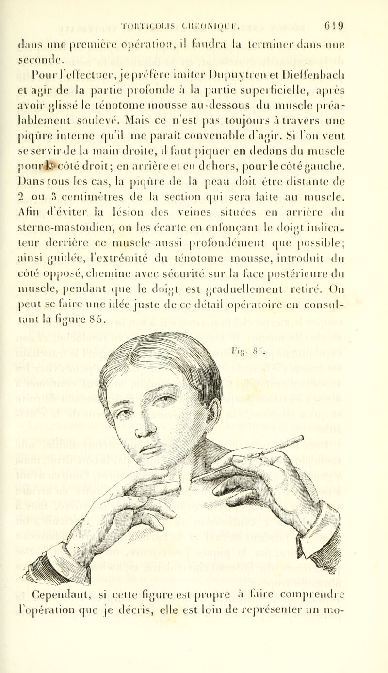 TOHTM.Ol.IS Clii'.OMOlT . G19 pans une première opération, il rancira la terminer dans une seconde1. Pour l'effectuer, je préfère imiter Dupuytren et Dieffcnbach et agir de la partie profonde à la partie superficielle, après avoir glissé le ténotome mousse au-dessous du muscle préa- lablement soulève'. Mais ce n'est pas toujours à travers une piqûre interne qu'il me parait convenable d'agir. Si l'on vent seservirde la main droite, il faut piquer en dedans du muscle pourjo»côté droit; en arrière et en dehors, pour le côté gauche. Dans tous les cas, la piqûre de la peau doit être distante de 2 ou 3 centimètres de la section qui sera faite au muscle. Afin d'éviter la lésion des veines situées en arrière du sterno-mastoïdien, on les écarte en enfonçant le doigt indica- teur derrière ce muscle aussi profondément que possible; ainsi guidée, l'extrémité du ténotome mousse, introduit du côté opposé, chemine avec sécurité sur la face postérieure du muscle, pendant que le doigt est graduellement retiré. On peut se faire une idée juste de ce détail opératoire en consul- tant la figure 8 5. Cependant, si cette figure est propre à faire comprendre l'opération que je décris, elle est loin de représenter un mo-