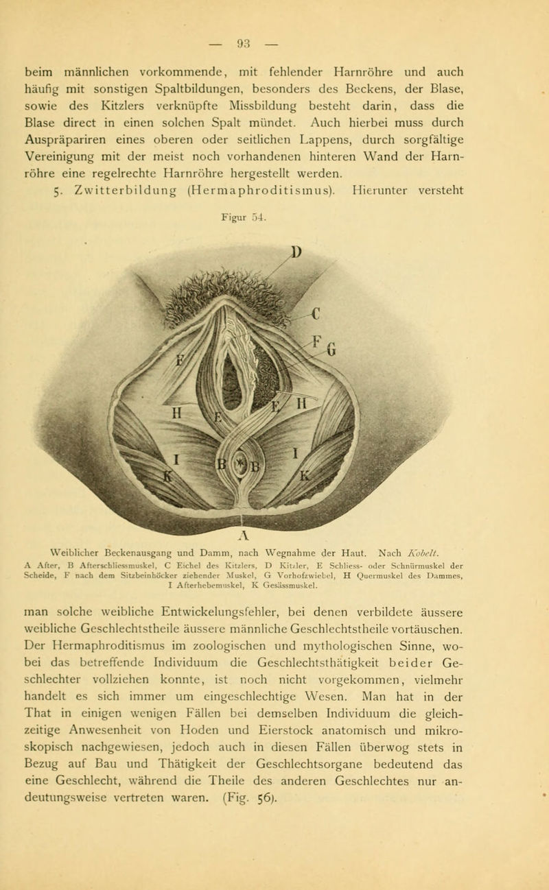 beim männlichen vorkommende, mit fehlender Harnröhre und auch häufig mit sonstigen Spaltbildungen, besonders des Beckens, der Blase, sowie des Kitzlers verknüpfte Missbildung besteht darin, dass die Blase direct in einen solchen Spalt mündet. Auch hierbei muss durch Auspräpariren eines oberen oder seitlichen Lappens, durch sorgfältige Vereinigung mit der meist noch vorhandenen hinteren Wand der Harn- röhre eine regelrechte Harnröhre hergestellt werden. 5. Zwitterbildung (Hermaphroditismus). Hierunter versteht Figur 54. Weiblicher Beckenausgang und Damm, nach Wegnahme der Haut. Nach Kobelt. A After, IS Afterschliessmuskel, C Eichel de-. Kitzlers, D Kittler, E Schliess- oder Si hniirmuskel der Scheide, F nach dem Sitzbeinhücker ziehender Muskel, <■ Vorbofzwiebel, H Quermuskel des Dammes, I Afterhcbemtiskel, K Gesüssmuskcl. man solche weibliche Entwickelungsfehler, bei denen verbildete äussere weibliche Geschlechtstheile äussere männliche Geschlechtstheile vortäuschen. Der Hermaphroditismus im zoologischen und mythologischen Sinne, wo- bei das betreffende Individuum die Geschlechtsthätigkeit beider Ge- schlechter vollziehen konnte, ist noch nicht vorgekommen, vielmehr handelt es sich immer um eingeschlechtige Wesen. Man hat in der That in einigen wenigen Fällen bei demselben Individuum die gleich- zeitige Anwesenheit von Hoden und Eierstock anatomisch und mikro- skopisch nachgewiesen, jedoch auch in diesen Fällen überwog stets in Bezug auf Bau und Thätigkeit der Geschlechtsorgane bedeutend das eine Geschlecht, während die Theile des anderen Geschlechtes nur an- deutungsweise vertreten waren. (Fig. 56).