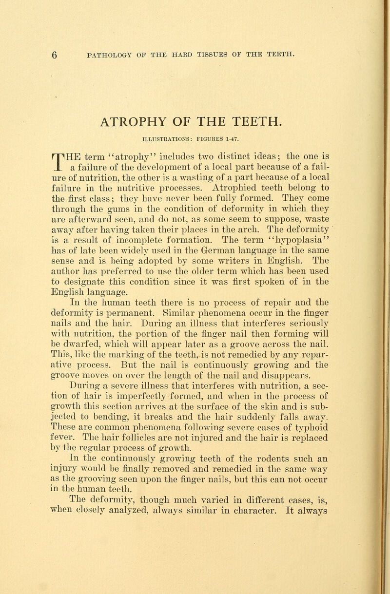 ATROPHY OF THE TEETH. ILLUSTRATIONS: FIGURES 1-47. THE term atrophy includes two distinct ideas; the one is a failure of the development of a local part because of a fail- ure of nutrition, the other is a wasting of a part because of a local failure in the nutritive processes. Atrophied teeth belong to the first class; they have never been fully formed. They come through the gums in the condition of deformity in which they are afterward seen, and do not, as some seem to suppose, waste away after having taken their places in the arch. The deformity is a result of incomplete formation. The term hypoplasia has of late been widely used in the German language in the same sense and is being adopted by some writers in English. The author has preferred to use the older term which has been used to designate this condition since it was first spoken of in the English language. In the human teeth there is no process of repair and the deformity is permanent. Similar phenomena occur in the finger nails and the hair. During an illness that interferes seriously with nutrition, the portion of the finger nail then forming will be dwarfed, which will appear later as a groove across the nail. This, like the marking of the teeth,, is not remedied by any repar- ative process. But the nail is continuously growing and the groove moves on over the length of the nail and disappears. During a severe illness that interferes with nutrition, a sec- tion of hair is imperfectly formed, and when in the process of growth this section arrives at the surface of the skin and is sub- jected to bending, it breaks and the hair suddenly falls away. These are common phenomena following severe cases of typhoid fever. The hair follicles are not injured and the hair is replaced by the regular process of growth. In the continuously growing teeth of the rodents such an injury would be finally removed and remedied in the same way as the grooving seen upon the finger nails, but this can not occur in the human teeth. The deformity, though much varied in different cases, is, when closely analyzed, always similar in character. It always