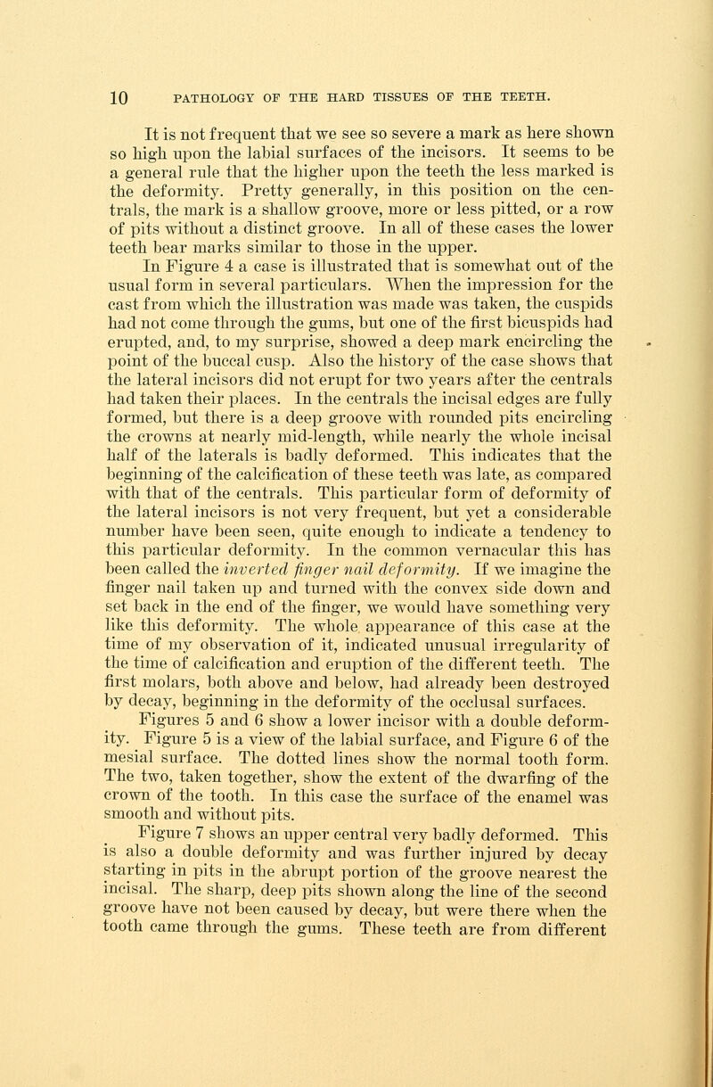 It is not frequent that we see so severe a mark as here shown so high upon the labial surfaces of the incisors. It seems to be a general rule that the higher upon the teeth the less marked is the deformity. Pretty generally, in this position on the cen- trals, the mark is a shallow groove, more or less pitted, or a row of pits without a distinct groove. In all of these cases the lower teeth bear marks similar to those in the upper. In Figure 4 a case is illustrated that is somewhat out of the usual form in several particulars. When the impression for the cast from which the illustration was made was taken, the cuspids had not come through the gums, but one of the first bicuspids had erupted, and, to my surprise, showed a deep mark encircling the point of the buccal cusp. Also the history of the case shows that the lateral incisors did not erupt for two years after the centrals had taken their places. In the centrals the incisal edges are fully formed, but there is a deep groove with rounded pits encircling the crowns at nearly mid-length, while nearly the whole incisal half of the laterals is badly deformed. This indicates that the beginning of the calcification of these teeth was late, as compared with that of the centrals. This particular form of deformity of the lateral incisors is not very frequent, but yet a considerable number have been seen, quite enough to indicate a tendency to this particular deformity. In the common vernacular this has been called the inverted finger nail deformity. If we imagine the finger nail taken up and turned with the convex side down and set back in the end of the finger, we would have something very like this deformity. The whole appearance of this case at the time of my observation of it, indicated unusual irregularity of the time of calcification and eruption of the different teeth. The first molars, both above and below, had already been destroyed by decay, beginning in the deformity of the occlusal surfaces. Figures 5 and 6 show a lower incisor with a double deform- ity. Figure 5 is a view of the labial surface, and Figure 6 of the mesial surface. The dotted lines show the normal tooth form. The two, taken together, show the extent of the dwarfing of the crown of the tooth. In this case the surface of the enamel was smooth and without pits. Figure 7 shows an upper central very badly deformed. This is also a double deformity and was further injured by decay starting in pits in the abrupt portion of the groove nearest the incisal. The sharp, deep pits shown along the line of the second groove have not been caused by decay, but were there when the tooth came through the gums. These teeth are from different