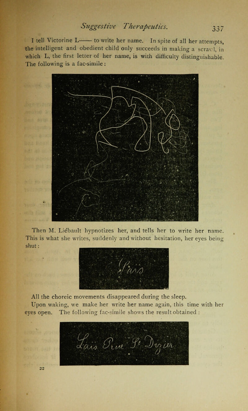 I tell Victorine L- to write her name. In spite of all her attempts, the intelligent and obedient child only succeeds in making a scrawl, in which L, the first letter of her name, is with difficulty distinguishable. The following is a fac-simile : Then M. Lie'bault hypnotizes her, and tells her to write her name. This is what she writes, suddenly and without hesitation, her eyes being- shut : All the choreic movements disappeared during the sleep. Upon waking, we make her write her name again, this time with her eyes open. The following fac-simile shows the result obtained :